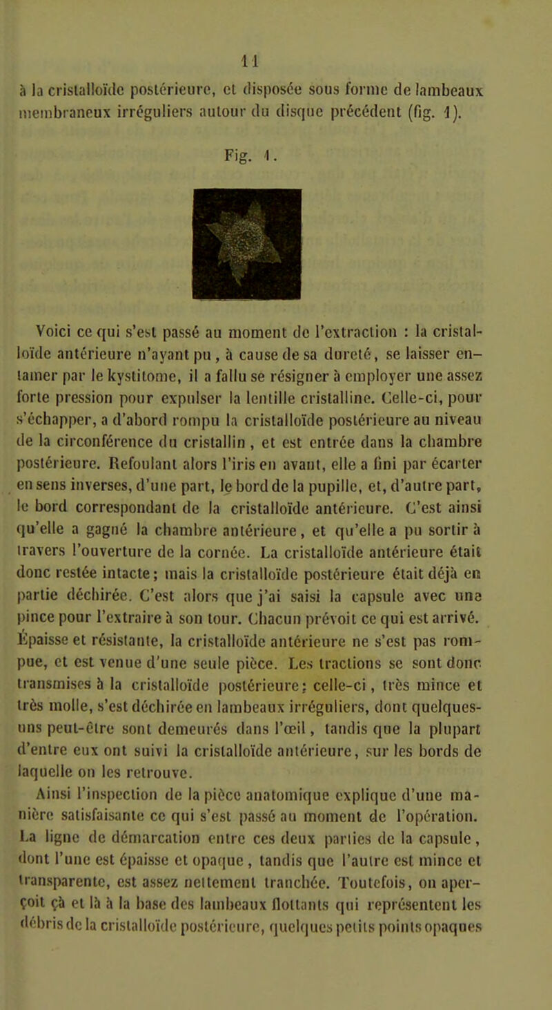 à la crislalloïïlc poslérieiirc, cl disposée sous forme de lambeaux meinbi ancux irréguliers autour du disque précédent (fig. 1), Fig. 1. Voici ce qui s'est passé au moment de l'extraction : la cristal- loïde antérieure n'ayant pu, à cause de sa dureté, se laisser en- tamer par le kystitome, il a fallu se résigner à employer une assez forte pression pour expulser la lentille cristalline. Celle-ci, pour s'échapper, a d'abord rompu la cristalloïde postérieure au niveau de la circonférence du cristallin , et est entrée dans la chambre postérieure. Refoulant alors l'iris en avant, elle a fjni par écarter en sens inverses, d'une part, le bord de la pupille, et, d'autre part, lu bord correspondant de la cristalloïde antérieure. C'est ainsi qu'elle a gagné la chambre antérieure, et qu'elle a pu sortira iravers l'ouverture de la cornée. La cristalloïde antérieure était donc restée intacte; mais la cristalloïde postérieure était déjà en partie déchirée. C'est alors que j'ai saisi la capsule avec una pince pour l'extraire h son tour. Chacun prévoit ce qui est arrivé. Épaisse et résistante, la cristalloïde antérieure ne s'est pas rom- pue, et est venue d'une seule pièce. Les tractions se sont donc transmises à la cristalloïde postérieure; celle-ci, très mince et très molle, s'est déchirée en lambeaux irréguliers, dont quelques- uns peut-être sont demeurés dans l'œil, tandis que la plupart d'entre eux ont suivi la cristalloïde antérieure, sur les bords de laquelle on les retrouve. Ainsi l'inspection de la pièce anatomique explique d'une ma- nière satisfaisante ce qui s'est passé au moment de l'opération. La ligne de démarcation entre ces deux parlics de la capsule, dont l'une est épaisse et opatjue , tandis que l'autre est mince et transparente, est assez neltcment tranchée. Toutefois, on aper- çoit çh et là h la base des lambeaux flottants qui représentent les df'bris de la cristalloïde postérieure, quelques petits points opaques