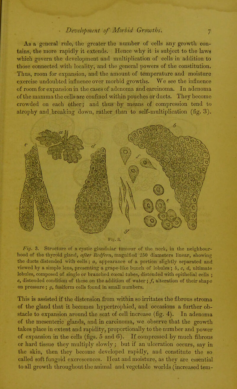 As a general rule, the greater the number of cells any growth con- tains, the more rapidly it extends. Hence why it is subject to the laws which govern the development and multiplication of cells in addition to those connected with locality, and the general powers of the constitution. Thus, room for expansion, and the amount of temperature and moisture exercise undoubted influence over morbid growths. We see the influence of room for expansion in the cases of adenoma and carcinoma. In adenoma of the mamma the cells are confined within pouches or ducts. They become crowded on each other; and thus by means of compression tend to atrophy and breaking down, rather than to self-multiplication (fig. 3). 6 Fig. 3. Fig. 3. Structure of a cystic glandular tumour of the neck, in the neighbour- hood of the thyroid gland, after Itedfern, magnified 250 diameters linear, showing the ducts distended with cells; a, appearance of a portion slightly separated and viewed by a simple lens, presenting a grape-like bunch of lobules ; b, c, d, ultimate lobules, composed of single or branched coecal tubes, distended with epithelial cells ; e, distended condition of those on the addition of water; /, alteration of their shape on pressure; g, fusiform cells found in small numbers. This is assisted if the distension from within so irritates the fibrous stroma of the gland that it becomes hypertrophied, and occasions a further ob- stacle to expansion around the scat of cell increase (fig. 4). In adenoma of the mesenteric glands, and in carcinoma, we observe that the growth takes place in extent and rapidity, proportionally to the number and power of expansion in the cells (figs. 5 and 6). If compressed by much fibrous or hard tissue they multiply slowly; but if an ulceration occurs, say in the skin, then they become developed rapidly, and constitute the so called soft fungoid excrescences. II cat and moisture, as they arc essential to all growth throughout the animal and vcgetablo worlds (increased tern-