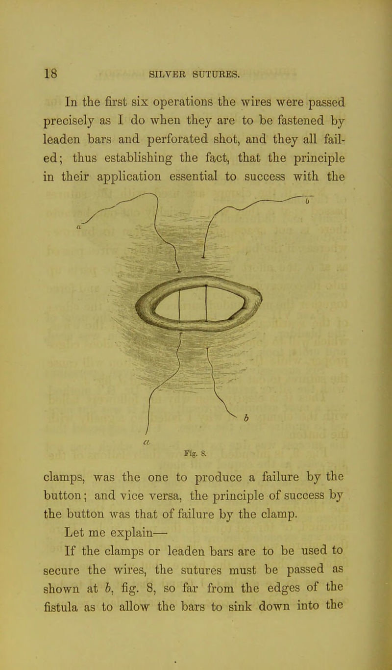 In the first six operations the wires were passed precisely as I do when they are to be fastened by leaden bars and perforated shot, and they all fail- ed; thus establishing the fact, that the principle in their application essential to success with the a. Pig. 8. clamps, was the one to produce a failure by the button; and vice versa, the principle of success by the button was that of failure by the clamp. Let me explain— If the clamps or leaden bars are to be used to secure the wires, the sutures must be passed as shown at 5, fig. 8, so far from the edges of the fistula as to allow the bars to sink down into the