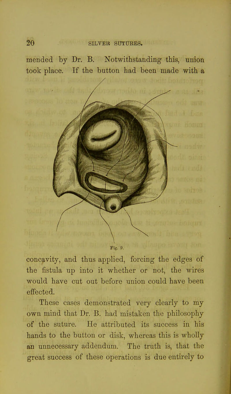 mended by Dr. B. Notwithstanding this, union took place. If the button had been made with a Fig. 9. concavity, and thus applied, forcing the edges of the fistula up into it whether or not, the wires would have cut out before union could have been effected. These cases demonstrated very clearly to my own mind that Dr. B. had mistaken the philosophy of the suture. He attributed its success in his hands to the button or disk, whereas this is wholly an unnecessary addendum. The truth is, that the great success of these operations is due entirely to