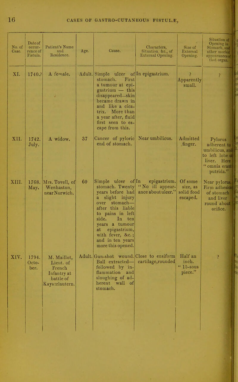 Date of No. of occur- Ciise. rence of Fistula. XI. 1740.? XII. 1742. July. XIII. 1768. May. XIV. 1794. Octo- ber. Patient's Name and Eesidence, A fenale. A widow. Mrs. Tovell, of Wenhastoii, near Norwich. M. Maillot, Lieut, of French Infantry at battle of Kayssrlautern. Age. Adult 37 60 Adult. Cause. Simple ulcer of stomach. First a tumour at epi- gastrium — this disappeared—skin became draw n in and like a cica- trix. More than a year after, fluid first seen to es cape from this. Cancer of pyloric end of stomach Simple ulcer of stomach. Twenty years before had a slight injury over stomach after this liable to pains in left side. In ten years a tumour at epigastrium, witli fever, &c.; and in ten years more this opened. Gun-shot wound. Ball extracted— followed by in- flammation and sloughing of ad- herent wall of stomach. Cliaracters, Situation. &c., of External Opening. In epigastrium. Near umbilicus. In epigastrium,  No ill appear- ance about ulcer.*' Close to ensiform cartilage,rounded Size of External Opening. Apparently small. Admitted . finger. Of some size, as solid food escaped. Half an inch.  1.5-sous piece.'