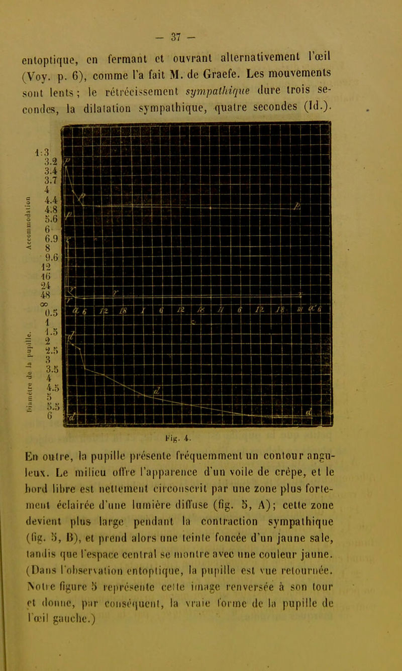 enloptique, en l'ermaiU et ouvrant allernativement l'œil (Voy. p. 6), comme l'a fait M. de Graefe. Les mouvements sont lents ; le rétrécissement sympathique dure trois se- condes, la dilatation sympathique, quatre secondes (Id.)- Kig. i. En outre, la pupille présente fréquemment un contour angu- leux. Le milieu otlVe l'apparence d'un voile de crêpe, et le bord libre est netiemenl circonscrit par une zone plus forle- nuîiii éclairée d'une lumière difl'nse (fîg. 5, A); celte zone devient plus large pendant la contraction sympathique (fig. b, B), el prend alors une teinte foncée d'un jaune sale, tandis que lespace central se montre avec une couleur jaune. (Dans l'observaiion entopliqiie, la pupille est vue retournée. >olie figure 5 représente celle image renversée à son tour cl donne, pur conséquent, la vraie forme de la pupille de rail gauche.)