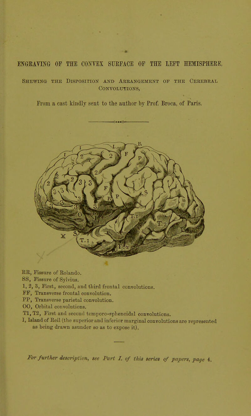 ■* ENGRAYMG OP THE CONVEX SUEFACE OP THE LEFT HEMISPHERE, Shewing the Disposipion and Akkangement of the Cerebral Convolutions, Fi-om a cast kindly sent to the author hy Prof, Broca, of Paris. ER, Fissure of Eolando. SS, Fissure of Sylvius. 1, 2, 3, First, second, and tliird frontal convolutions. FF, Transverse frontal convolution. PP, Transverse parietal convolution. 00, Orbital convolutions. T1,T2, First and second temporo-sphenoidal convolutions. 1, Island of Eeil (the superior and inferior marginal convolutions are represented as being drawn asunder so as to expose it).