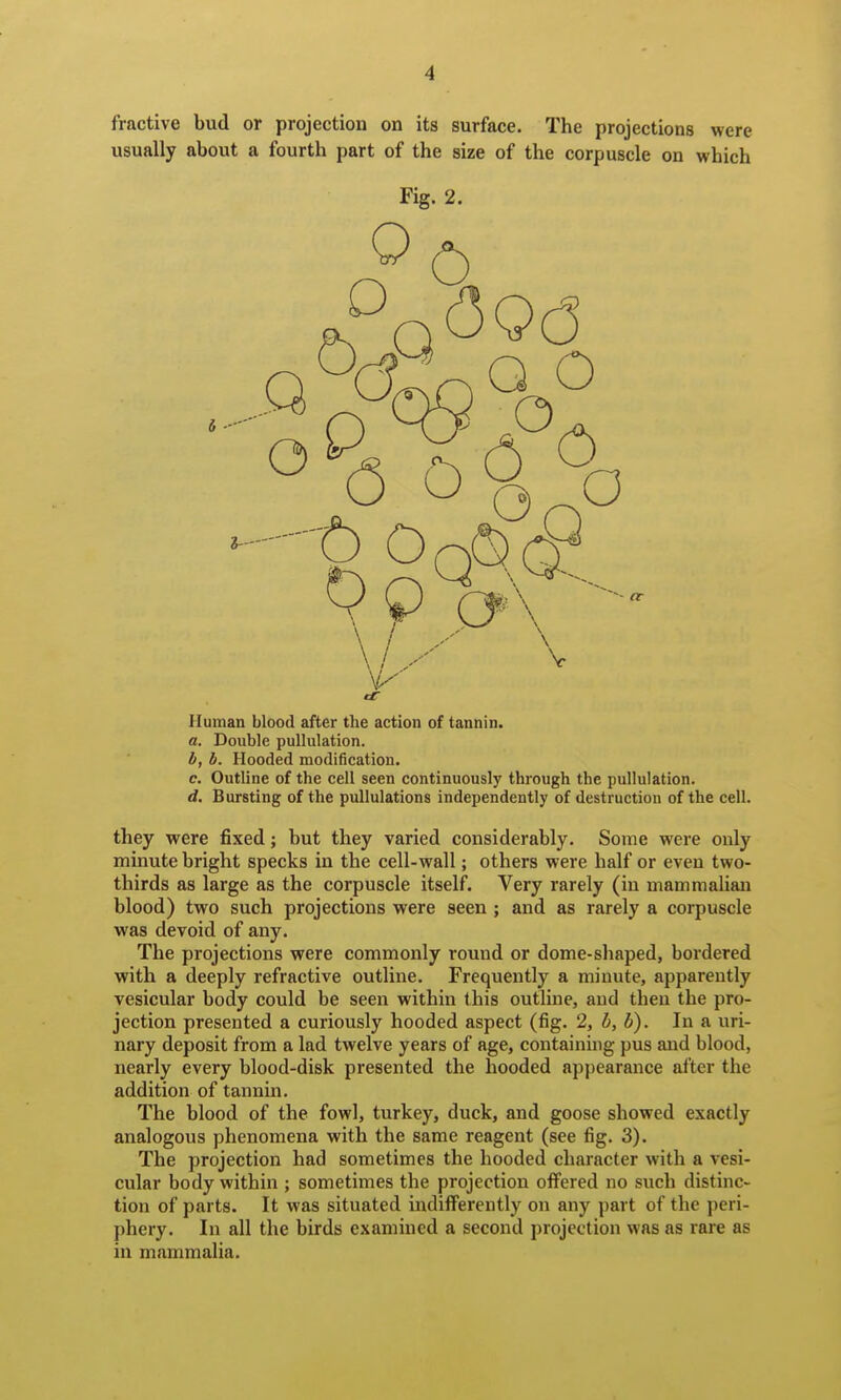 fractive bud or projection on its surface. The projections were usually about a fourth part of the size of the corpuscle on which Fig. 2. o - I--- Human blood after the action of tannin. a. Double puUulation. i, b. Hooded modification. c. Outline of the cell seen continuously through the pullulation. d. Bursting of the puUulations independently of destruction of the cell. they were fixed; but they varied considerably. Some were only minute bright specks in the cell-wall; others were half or even two- thirds as large as the corpuscle itself. Very rarely (in mammaUan blood) two such projections were seen ; and as rarely a corpuscle was devoid of any. The projections were commonly round or dome-shaped, bordered with a deeply refractive outline. Frequently a minute, apparently vesicular body could be seen within this outline, and then the pro- jection presented a curiously hooded aspect (fig. 2, h, b). In a uri- nary deposit from a lad twelve years of age, containing pus and blood, nearly every blood-disk presented the hooded appearance after the addition of tannin. The blood of the fowl, turkey, duck, and goose showed exactly analogous phenomena with the same reagent (see fig. 3). The projection had sometimes the hooded character with a vesi- cular body within ; sometimes the projection offered no such distinc- tion of parts. It was situated indifferently on any part of the peri- phery. In all the birds examined a second projection was as rare as in mammalia.