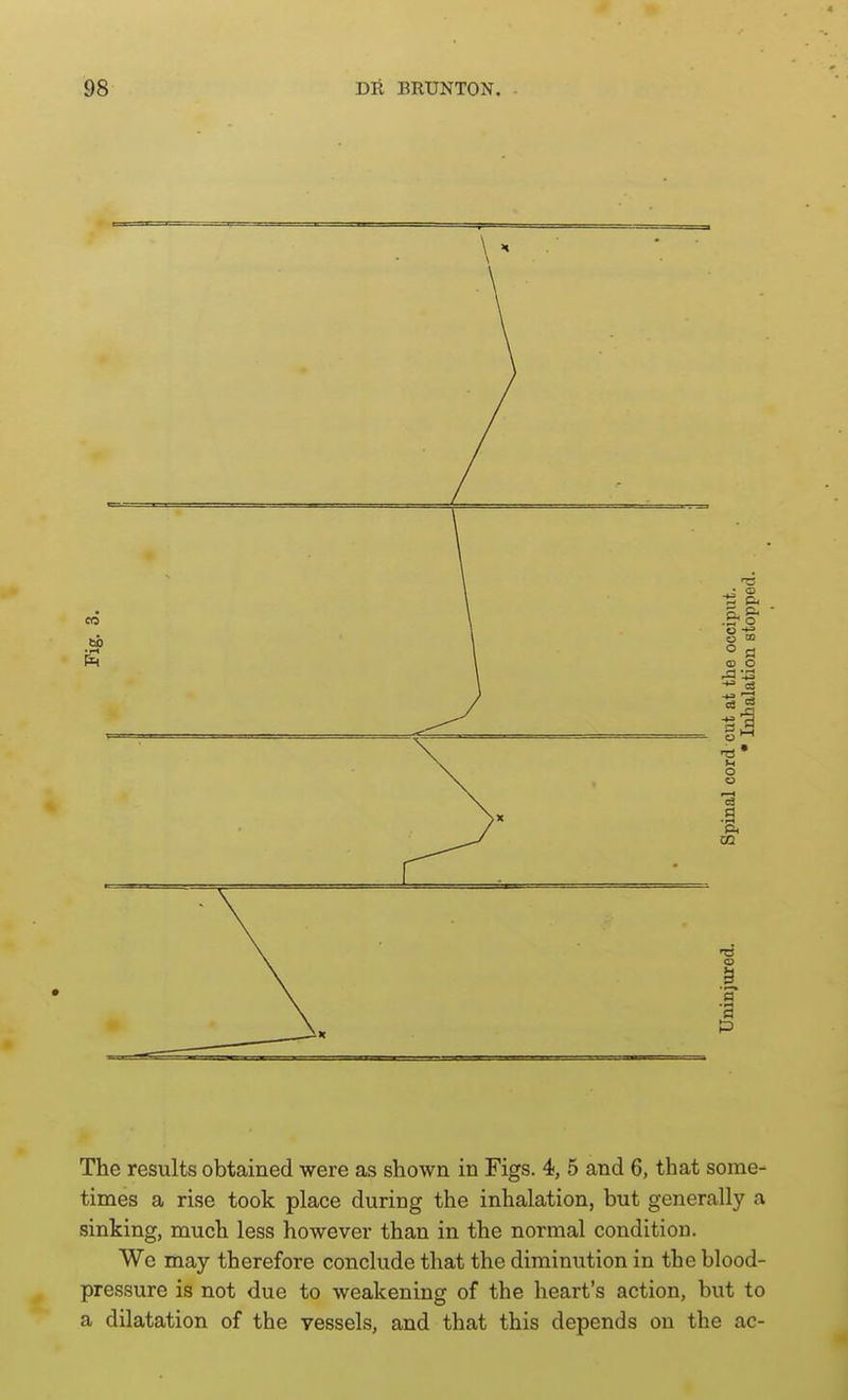 13 (D .a a P The results obtained were as shown in Figs. 4, 5 and 6, that some- times a rise took place during the inhalation, but generally a sinking, much less however than in the normal condition. We may therefore conclude that the diminution in the blood- pressure is not due to weakening of the heart's action, but to a dilatation of the vessels, and that this depends on the ac-