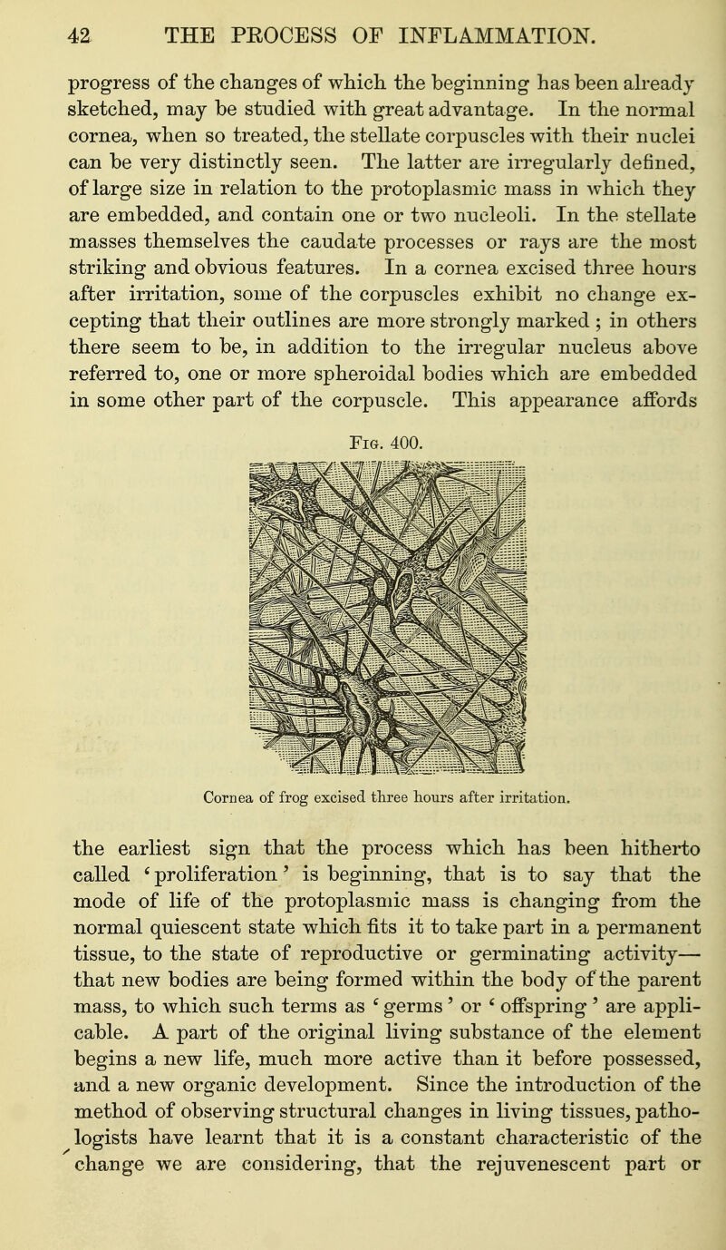 progress of the changes of which the beginning has been abeadj sketched, may be studied with great advantage. In the normal cornea, when so treated, the stellate corpuscles with their nuclei can be very distinctly seen. The latter are irregularly defined, of large size in relation to the protoplasmic mass in which they are embedded, and contain one or two nucleoli. In the stellate masses themselves the caudate processes or rays are the most striking and obvious features. In a cornea excised three hours after irritation, some of the corpuscles exhibit no change ex- cepting that their outlines are more strongly marked ; in others there seem to be, in addition to the irregular nucleus above referred to, one or more spheroidal bodies which are embedded in some other part of the corpuscle. This appearance affords Fig. 400. Cornea of frog excised three hours after irritation. the earliest sign that the process which has been hitherto called ' proliferation' is beginning, that is to say that the mode of life of the protoplasmic mass is changing from the normal quiescent state which fits it to take part in a permanent tissue, to the state of reproductive or germinating activity— that new bodies are being formed within the body of the parent mass, to which such terms as ^ germs' or ' offspring' are appli- cable. A part of the original living substance of the element begins a new life, much more active than it before possessed, and a new organic development. Since the introduction of the method of observing structural changes in living tissues, patho- logists have learnt that it is a constant characteristic of the change we are considering, that the rejuvenescent part or