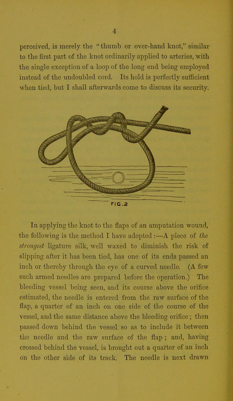 perceived, is merely the  thumb or over-hand knot, similar to the first part of the knot ordinarily applied to arteries, with the single exception of a loop of the long end being employed instead of the undoubled cord. Its hold is perfectly sufficient when tied, but I shall afterwards come to discuss its security. FIG.2 In applying the knot to the flaps of an amputation wound, the following is the method I have adopted :—A piece of the strongest ligature silk, well waxed to diminish the risk of slipping after it has been tied, has one of its ends passed an inch or thereby through the eye of a curved needle. (A few such armed needles are prepared before the operation.) The bleeding vessel being seen, and its course above the orifice estimated, the needle is entered from the raw surface of the flap, a quarter of an inch on one side of the course of the vessel, and the same distance above the bleeding orifice; then passed down behind the vessel so as to include it between the needle and the raw surface of the flap ; and, having crossed behind the vessel, is brought out a quarter of an inch on the other side of its track. The needle is next drawn