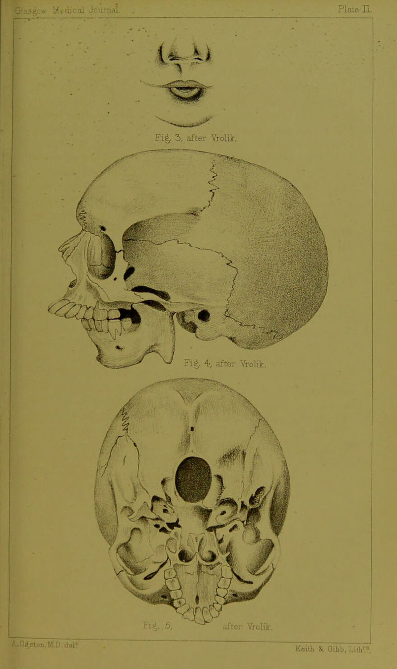 Fi|. 3, after Vrolii:. Koith Jk. Gibb, hhV..