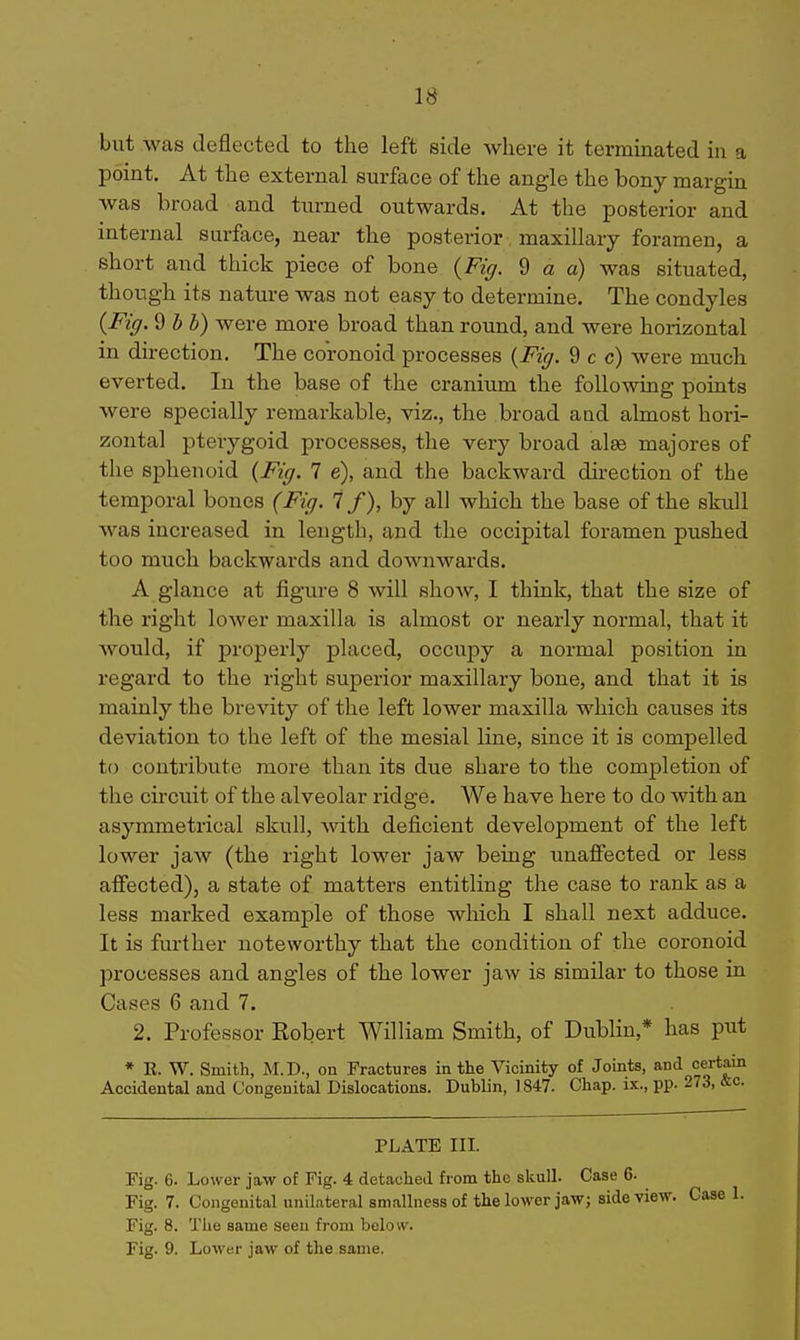 but was deflected to the left side where it terminated in a point. At the external surface of the angle the bony margin was broad and turned outwards. At the posterior and internal surface, near the posterior, maxillary foramen, a short and thick piece of bone {Fig. % a a) was situated, though its nature was not easy to determine. The condyles {Fig. d bb) were more broad than round, and were horizontal in direction. The coronoid processes {Fig. 9 c c) were much everted. In the base of the cranium the following points were specially remarkable, viz., the broad aad almost hori- zontal pterygoid processes, the very broad alge majores of the sphenoid (Fig. 7 e), and the backward du-ection of the temporal bones (Fig. 7 /), by all which the base of the skull was increased in length, and the occipital foramen pushed too much backwards and downwards. A glance at figure 8 will shoAv, I think, that the size of the right lower maxilla is almost or nearly normal, that it would, if properly placed, occupy a normal position in regard to the right superior maxillary bone, and that it is mainly the brevity of the left lower maxilla which causes its deviation to the left of the mesial line, since it is compelled to contribute more than its due share to the completion of the circuit of the alveolar ridge. We have here to do with an asymmetrical skull, -with deficient development of the left lower jaw (the right lower jaw being unaffected or less affected), a state of matters entitling the case to rank as a less marked example of those which I shall next adduce. It is further noteworthy that the condition of the coronoid processes and angles of the lower jaw is similar to those in Cases 6 and 7. 2. Professor Robert William Smith, of Dublin,* has put * K. W. Smith, M.D., on Fractures in the Vicinity of Joints, and certain Accidental and Congenital Dislocations. Dublin, 1847. Chap, ix., pp. 273, &c. PLATE III. Fig. 6. Lower jaw of Fig. 4 detached from the skull. Case 6. Fig. 7. Congenital unilateral smallnessof the lower jaw; side view. Case 1. Fig. 8. The same .seen from below. Fig. 9. Lower jaw of the same.