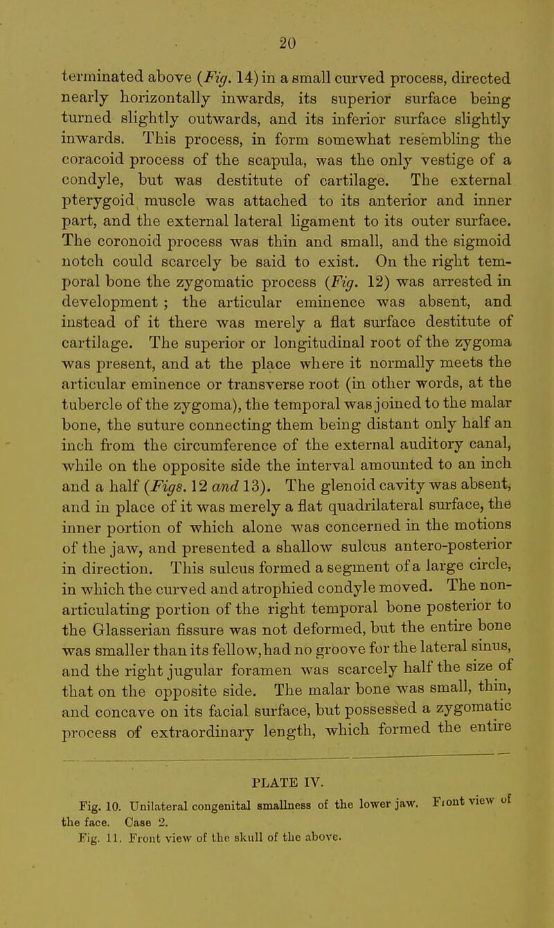 20 terminated above {Fig. 14) in a small curved process, directed nearly horizontally inwards, its siiperior surface being turned slightly outwards, and its inferior surface slightly inwards. This process, in form somewhat resembling the coracoid process of the scapula, was the only vestige of a condyle, but was destitute of cartilage. The external pterygoid muscle was attached to its anterior and inner part, and the external lateral ligament to its outer surface. The coronoid process was thin and small, and the sigmoid notch could scarcely be said to exist. On the right tem- poral bone the zygomatic process (Fig. 12) was arrested in development ; the articular eminence was absent, and instead of it there was merely a flat surface destitute of cartilage. The superior or longitudinal root of the zygoma was present, and at the place where it normally meets the articular eminence or transverse root (in other words, at the tubercle of the zygoma), the temporal was joined to the malar bone, the suture connecting them being distant only half an inch from the circumference of the external auditory canal, while on the opposite side the interval amounted to an inch and a half {Figs. 12 and 13). The glenoid cavity was absent, and in place of it was merely a flat quadrilateral surface, the inner portion of which alone was concerned in the motions of the jaw, and presented a shallow sulcus antero-posterior in direction. This sulcus formed a segment of a large circle, in which the curved and atrophied condyle moved. The non- articulating portion of the right temporal bone posterior to the Glasserian fissure was not deformed, but the entke bone was smaller than its fellow,had no groove for the lateral sinus, and the right jugular foramen was scarcely half the size of that on the opposite side. The malar bone was small, thm, and concave on its facial surface, but possessed a zygomatic process of extraordinary length, which formed the entu-e PLATE IV. Fig. 10. Unilateral congenital smallness of the lower jaw. Fiont yi the face. Case 2. Fig. 11. Front vieAV of the skull of the above.