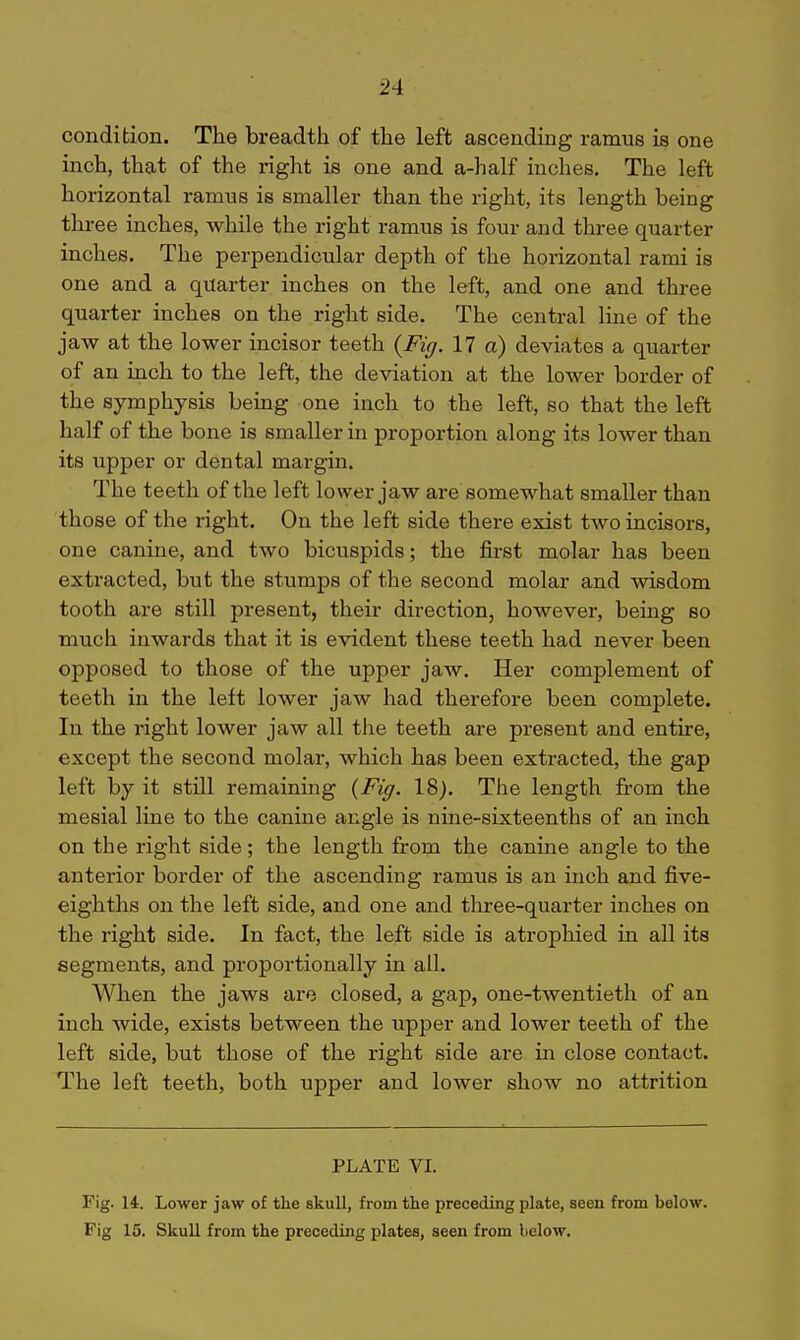 condition. The breadth of the left ascending ramus is one inch, that of the right is one and a-half inches. The left horizontal ramus is smaller than the right, its length being three inches, while the right ramus is four and three quarter inches. The perpendicular depth of the horizontal rami is one and a quarter inches on the left, and one and three quarter inches on the right side. The central line of the jaw at the lower incisor teeth {Fi(j. 17 a) deviates a quarter of an inch to the left, the deviation at the lower border of the symphysis bemg one inch to the left, eo that the left half of the bone is smaller in proportion along its lower than its upper or dental margin. The teeth of the left lower jaw are somewhat smaller than those of the right. On the left side there exist two incisors, one canine, and two bicuspids; the first molar has been exti'acted, but the stumps of the second molar and wisdom tooth are still present, their direction, however, being so much inwards that it is evident these teeth had never been opposed to those of the upper jaw. Her complement of teeth in the left lower jaw had therefore been complete. In the right lower jaw all the teeth are present and entire, except the second molar, which has been extracted, the gap left by it still remaining (Fiff. IS). The length from the mesial line to the canine angle is nine-sixteenths of an inch on the right side; the length from the canine angle to the anterior border of the ascending ramus is an inch and five- eighths on the left side, and one and three-quarter inches on the right side. In fact, the left side is atrophied in all its segments, and proportionally in all. When the jaws are closed, a gap, one-twentieth of an inch wide, exists between the upper and lower teeth of the left side, but those of the right side are in close contact. The left teeth, both upper and lower show no attrition PLATE VI. Fig. 14. Lower jaw of the skull, from the preceding plate, seen from below. Fig 15. Skull from the preceding plates, seen from below.