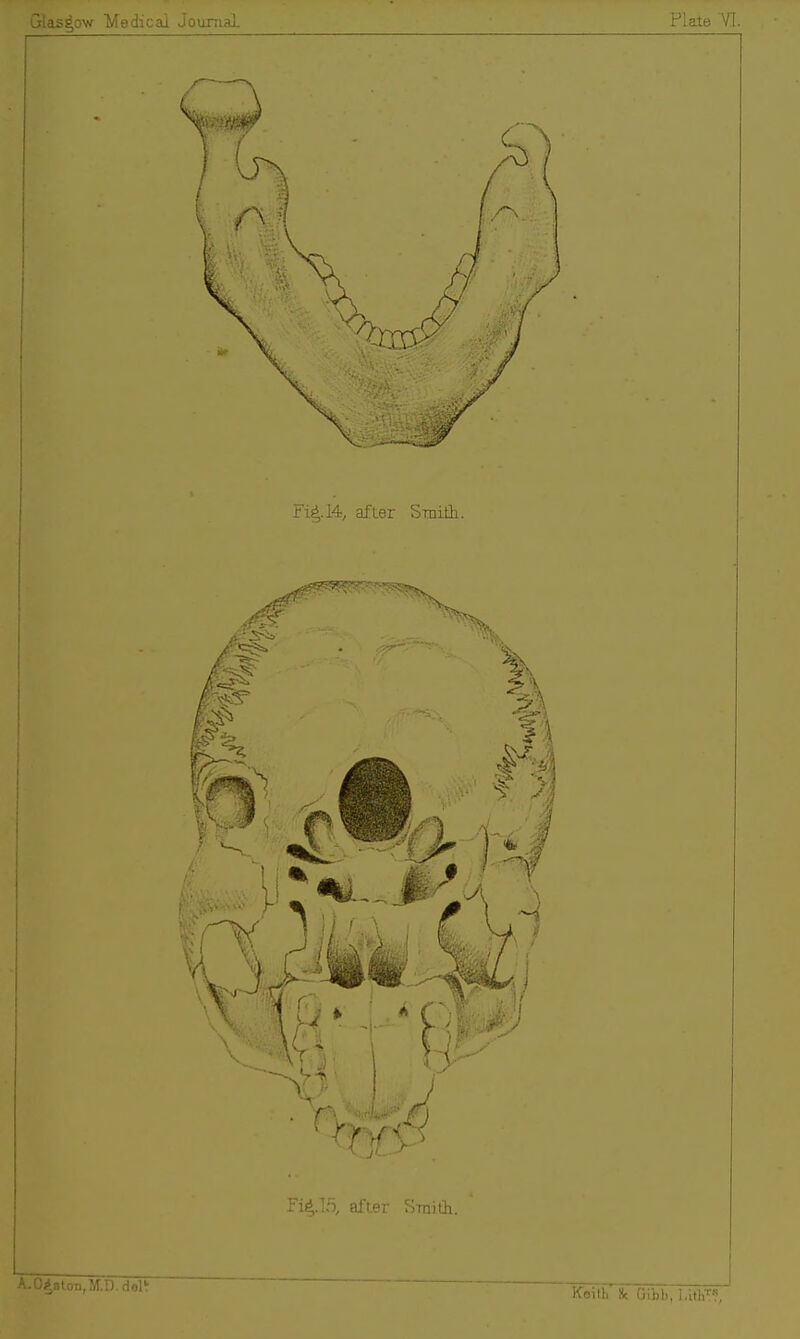 ilas^o'^ Medical Journal Plate VI. Fi^.l4, after Smith.