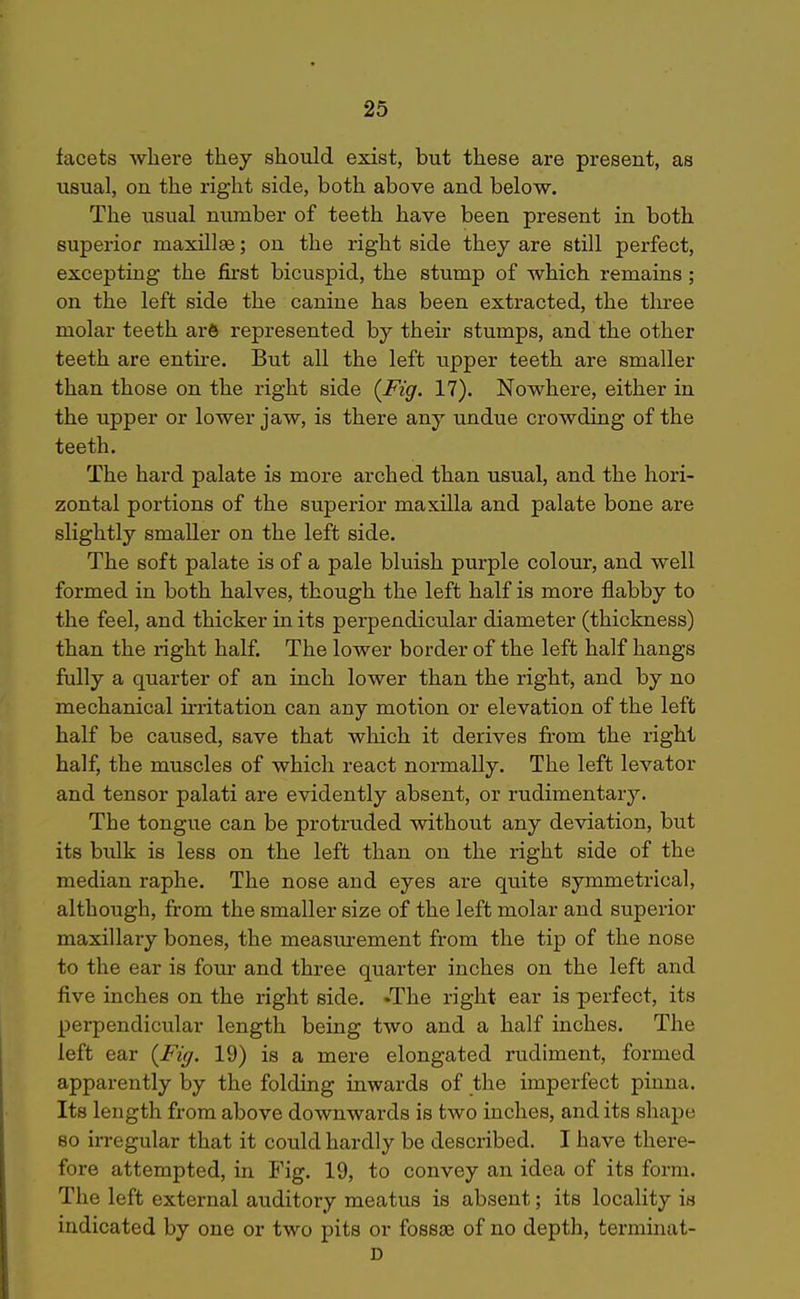 facets where they should exist, but these are present, as usual, on the right side, both above and below. The usual number of teeth have been present in both superior maxillee; on the right side they are still perfect, excepting the fii'st bicuspid, the stump of which remains ; on the left side the canine has been extracted, the tlu-ee molar teeth arS represented by their stumps, and the other teeth are entire. But all the left upper teeth are smaller than those on the right side {Fig. 17). Nowhere, either in the upper or lower jaw, is there any undue crowding of the teeth. The hard palate is more arched than usual, and the hori- zontal portions of the superior maxilla and palate bone are slightly smaller on the left side. The soft palate is of a pale bluish purple colour, and well formed in both halves, though the left half is more flabby to the feel, and thicker in its perpendicular diameter (thickness) than the right half. The lower border of the left half hangs fully a quarter of an inch lower than the right, and by no mechanical u-ritation can any motion or elevation of the left half be caused, save that which it derives fi-om the right half, the muscles of which react normally. The left levator and tensor palati are evidently absent, or rudimentary. The tongue can be protruded without any deviation, but its bulk is less on the left than on the right side of the median raphe. The nose and eyes are quite symmetrical, although, from the smaller size of the left molar and superior maxillary bones, the measiu'ement from the tip of the nose to the ear is four and three quarter inches on the left and five inches on the right side. •The right ear is perfect, its perpendicular length being two and a half inches. The left ear {Fig. 19) is a mere elongated rudiment, formed apparently by the folding inwards of the imperfect pinna. Its length from above downwards is two inches, and its sliajie 80 in-egular that it could hardly be described. I have there- fore attempted, in Fig. 19, to convey an idea of its form. The left external auditory meatus is absent; its locality is indicated by one or two pits or fossae of no depth, terminat- D