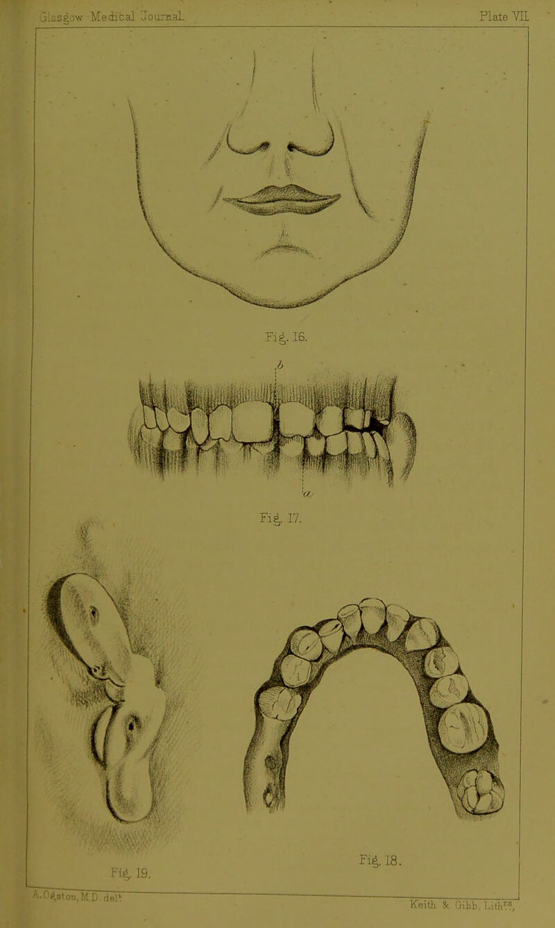 Tig. 16. .6 Fi|. 19. Fiil8.