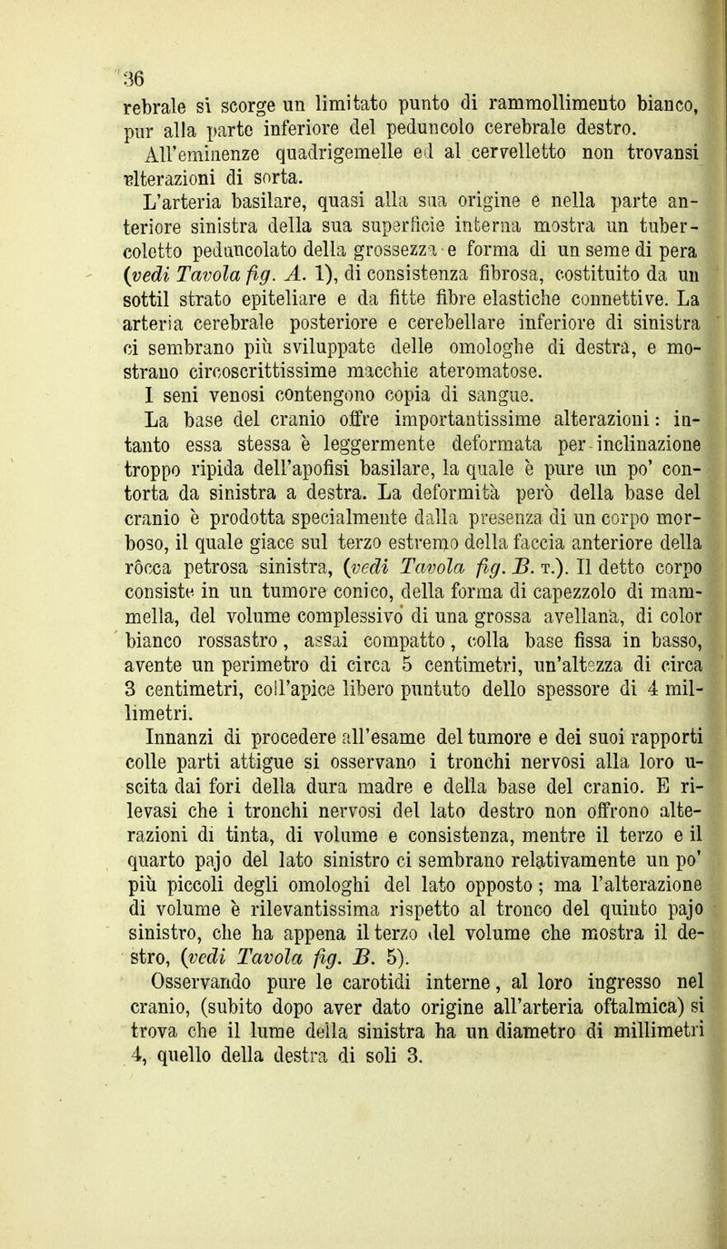 rebrale si scorge un limitato punto di rammollimento bianco, pur alla parte inferiore del peduncolo cerebrale destro. All'eminenze quadrigemelle ed al cervelletto non trovansi iterazioni di sorta. L'arteria basilare, quasi alla sua origine e nella parte an- teriore sinistra della sua superfìcie interna mostra un tuber- coletto peduncolato della grossezza e forma di un seme di pera {vedi Tavola fig. A. 1), di consistenza fibrosa, costituito da un sottil strato epiteliare e da fitte fibre elastiche connettive. La arteria cerebrale posteriore e cerebellare inferiore di sinistra ci sembrano più sviluppate delle omologhe di destra, e mo- strano circoscrittissime macchie ateromatose. 1 seni venosi contengono copia di sangue. La base del cranio offre importantissime alterazioni : in- tanto essa stessa è leggermente deformata per-inclinazione troppo ripida dell'apofisi basilare, la quale è pure un po' con- torta da sinistra a destra. La deformità però della base del cranio è prodotta specialmente dalla presenza di un corpo mor- boso, il quale giace sul terzo estremo della faccia anteriore della ròcca petrosa sinistra, {vedi Tavola fig. B. t.). Il detto corpo consiste in un tumore conico, della forma di capezzolo di mam- mella, del volume complessivo di una grossa avellana, di color ' bianco rossastro, assai compatto, colla base fissa in basso, avente un perimetro di circa 5 centimetri, un'altezza di circa 3 centimetri, col l'apice libero puntuto dello spessore di 4 mil- limetri. Innanzi di procedere all'esame del tumore e dei suoi rapporti colle parti attigue si osservano i tronchi nervosi alla loro u- scita dai fori della dura madre e della base del cranio. E ri- levasi che i tronchi nervosi del lato destro non offrono alte- razioni di tinta, di volume e consistenza, mentre il terzo e il quarto pajo del lato sinistro ci sembrano relativamente un po' più piccoli degli omologhi del lato opposto ; ma l'alterazione di volume è rilevantissima rispetto al tronco del quinto pajo sinistro, che ha appena il terzo del volume che mostra il de- stro, {vedi Tavola fig. B. 5). Osservando pure le carotidi interne, al loro ingresso nel cranio, (subito dopo aver dato origine all'arteria oftalmica) si trova che il lume della sinistra ha un diametro di millimetri 4, quello della destra di soli 3.