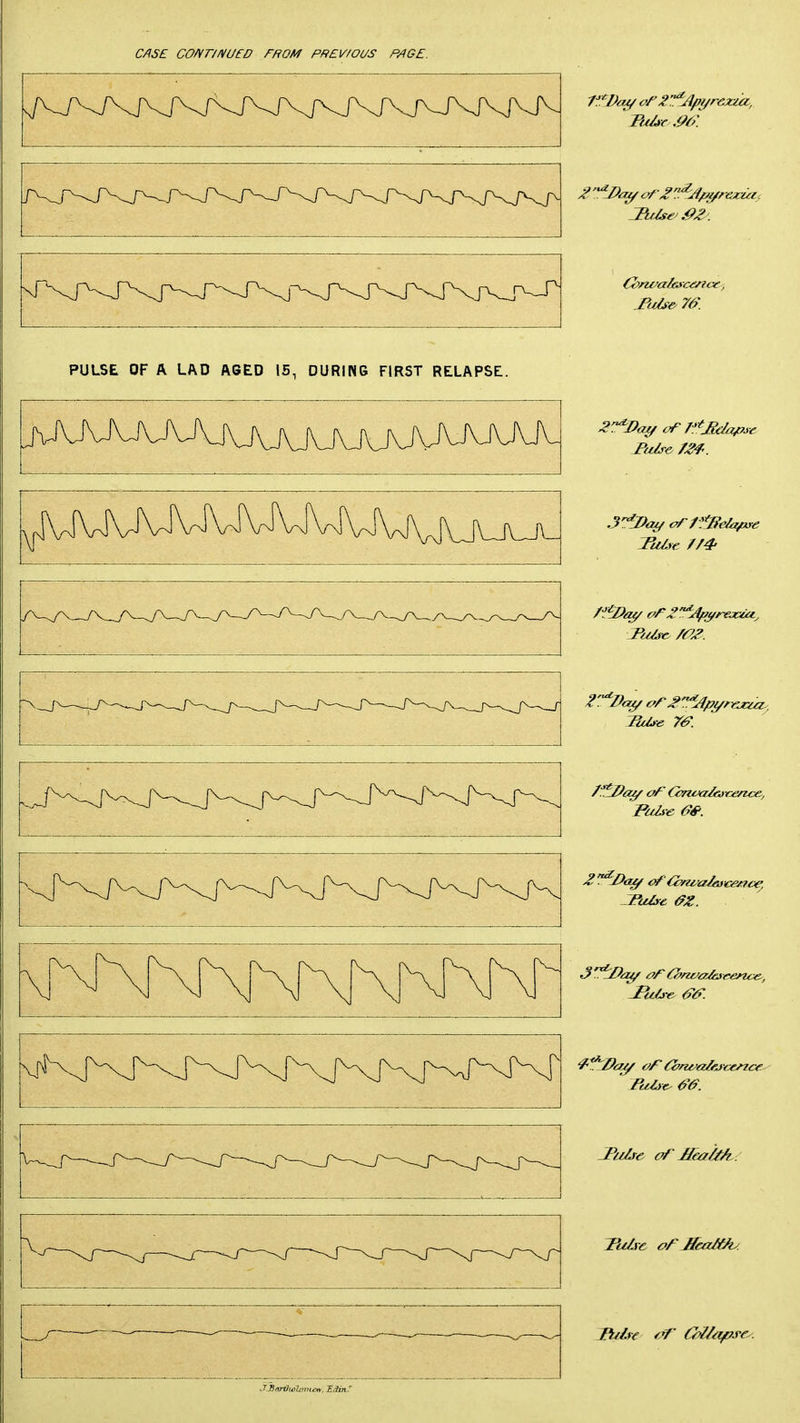 PULSE OF A LAD ASED IS, DURING FIRST RELAPSE. Tuli e //4' Tuis e /a^. 2. -Doff of 'dp/wa/oicence, JP/jlre oTlfea/^A