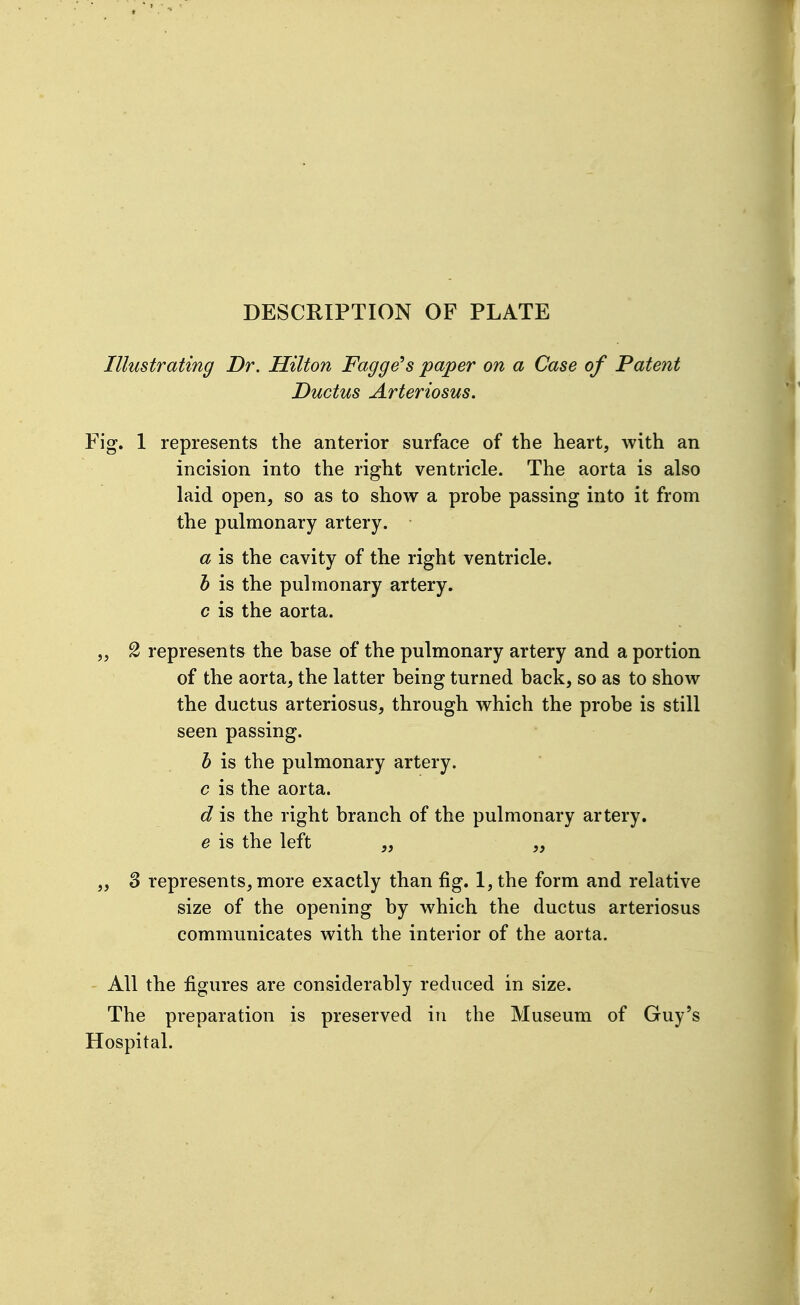 DESCRIPTION OF PLATE Illustrating Dr. Hilton Fagge's paper on a Case of Patent Ductus Arteriosus. Fig. 1 represents the anterior surface of the heart, with an incision into the right ventricle. The aorta is also laid open, so as to show a probe passing into it from the pulmonary artery. a is the cavity of the right ventricle. h is the pulmonary artery. c is the aorta. „ S represents the base of the pulmonary artery and a portion of the aorta, the latter being turned back, so as to show the ductus arteriosus, through which the probe is still seen passing. h is the pulmonary artery. e is the aorta. d is the right branch of the pulmonary artery. e is the left „ „ „ 3 represents, more exactly than fig. 1, the form and relative size of the opening by which the ductus arteriosus communicates with the interior of the aorta. All the figures are considerably reduced in size. The preparation is preserved in the Museum of Guy's Hospital.