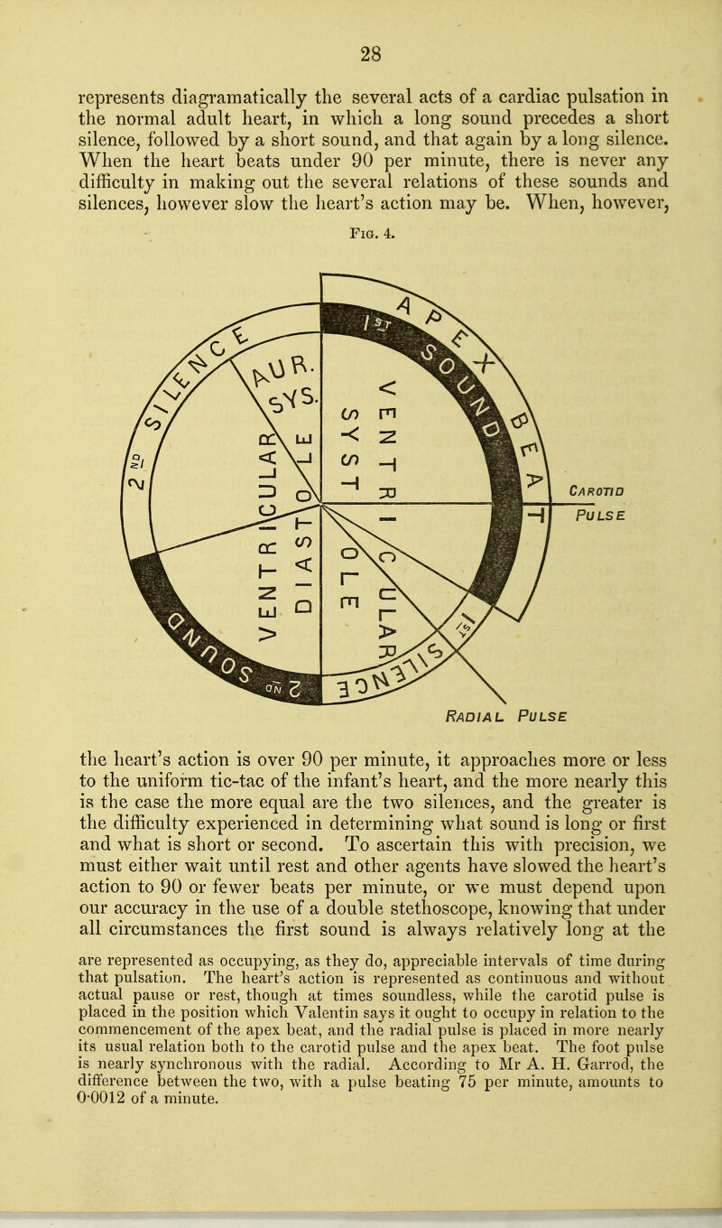 represents diagramatically the several acts of a cardiac pulsation in the normal adult heart, in which a long sound precedes a short silence, followed by a short sound, and that again by a long silence. When the heart beats under 90 per minute, there is never any difficulty in making out the several relations of these sounds and silences, however slow the heart's action may be. When, however, Fig. 4. Carotid Radial Pulse the heart's action is over 90 per minute, it approaches more or less to the uniform tic-tac of the infant's heart, and the more nearly this is the case the more equal are the two silences, and the greater is the difficulty experienced in determining what sound is long or first and what is short or second. To ascertain this with precision, we must either wait until rest and other agents have slowed the lieart's action to 90 or fewer beats per minute, or we must depend upon our accuracy in the use of a double stethoscope, knowing that under all circumstances the first sound is always relatively long at the are represented as occupying, as they do, appreciable intervals of time during that pulsation. The heart's action is represented as continuous and without actual pause or rest, though at times soundless, while the carotid pulse is placed in the position which Valentin says it ought to occupy in relation to the commencement of the apex beat, and the radial pulse is placed in more nearly its usual relation both to the carotid pulse and the apex beat. The foot pulse is nearly synchronous with the radial. According to Mr A. H. Garrod, the difference between the two, with a pulse beating 75 per minute, amounts to 0-0012 of a minute.