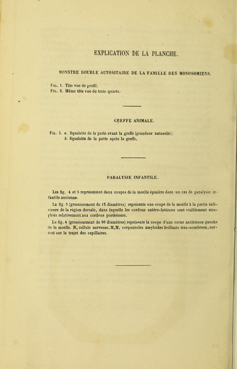 EXPLICATION DE LA PLANCHE. MONSTRE DOUBLE AUTOSITAIRE DE LA FAMILLE DES MONOSOMIENS. FiG, 1. Tête vue de profil. FiG. 2. Même tête vue de trois quarts.- GREFFE ANIMALE. FiG. 3. a. Squelette de la patte avant la greffe (grandeur naturelle). b. Squelette de la patte après la greffe. PARALYSIE INFANTILE. Les fig. 4 et 5 représentent deux coupes de la moelle épinière dans un cas de paralysie in- fantile ancienne. La fig. b (grossissement de i2 diamètres) représente une coupe de la moelle à la partie infé- rieure de la région dorsale, dans laquelle les cordons antéro-latéraux sont visiblement atro- phiés relativement aux cordons postérieurs. La fig. 4 (grossissement de 90 diamètres) représente la coi'.pe d'une corne antérieure gauche de la moelle. N, cellule nerveuse.M,M, corpuscules amyloides brillants très-nombreux,sur- tout sur le trajet des capillaires.