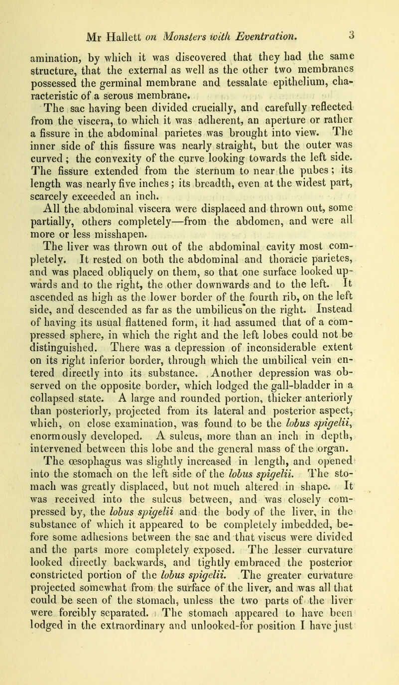amination, by which it was discovered that they had the same structure, that the external as well as the other two membranes possessed the germinal membrane and tessalate epithelium, cha- racteristic of a serous membrane. The sac having been divided crucially, and carefully reflected from the viscera, to which it was adherent, an aperture or rather a fissure in the abdominal parietes was brought into view. The inner side of this fissure was nearly straight, but the outer was curved; the convexity of the curve looking towards the left side. The fissure extended from the sternum to near the pubes; its length was nearly five inches; its breadth, even at the widest part, scarcely exceeded an inch. All jthe abdominal viscera were displaced and thrown out, some partially, others completely—from the abdomen, and were all more or less misshapen. The liver was thrown out of the abdominal cavity most com- pletely. It rested on both the abdominal and thoracic parietes, and was placed obliquely on them, so that one surface looked up- wards and to the right, the other downwards and to the left. It ascended as high as the lower border of the fourth rib, on the left side, and descended as far as the umbilicus'on the right. Instead of having its usual flattened form, it had assumed that of a com- pressed sphere, in which the right and the left lobes could not be distinguished. There was a depression of inconsiderable extent on its right inferior border, through which the umbilical vein en- tered directly into its substance. Another depression was ob- served on the opposite border, which lodged the gall-bladder in a collapsed state. A large and rounded portion, thicker anteriorly than posteriorly, projected from its lateral and posterior aspect, which, on close examination, was found to be the lobus spigelii^ enormously developed. A sulcus, more than an inch in depth, intervened between this lobe and the general mass of the organ. The oesophagus was slightly increased in length, and opened into the stomach on the left side of the lobus spigelii. The sto- mach was greatly displaced, but not much altered in shape. It was received into the sulcus between, and was closely com- pressed by, the lobus spigelii and the body of the liver, in the substance of which it appeared to be completely imbedded, be- fore some adhesions between the sac and that viscus were divided and the parts more completely exposed. The lesser curvature looked directly backwards, and tightly embraced the posterior constricted portion of the lobus spigelii. The greater curvature projected somewhat from the surface of the liver, and was all that could be seen of the stomach, unless the two parts of the liver were forcibly separated. ; The stomach appeared to have been lodged in the extraordinary and unlooked-for position I have just