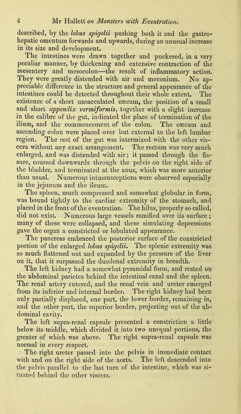 described, by the lohus spigelii pushing both it and the gastro- hepatic omentum forwards and upwards, during an unusual increase in its size and development. The intestines were drawn together and puckered, in a very peculiar manner, by thickening and extensive contraction of the mesentery and mesocolon—the result of inflammatory action. They were greatly distended with air and meconium. No ap- preciable difference in the structure and general appearance of the intestines could be detected throughout their whole extent. The existence of a short unsacculated caecum, the position of a small and short appendix vermiformis^ together with a slight increase in the calibre of the gut, indicated the place of termination of the ilium, and the commencement of the colon. The caecum and ascending colon were placed over but external to the left lumbar region. The rest of the gut was intermixed with the other vis- cera without any exact arrangement. The rectum was very much enlarged, and was distended with air; it passed through the fis- sure, coursed downwards through the pelvis on the right side of the bladder, and terminated at the anus, which was more anterior than usual. Numerous intussusceptions were observed especially in the jejunum and the ileum. The spleen, much compressed and somewhat globular in form, was bound tightly to the cardiac extremity of the stomach, and placed in the front of the eventration. The hilus, properly so called, did not exist. Numerous large vessels ramified over its surface ; many of these were collapsed, and these simulating depressions gave the organ a constricted or lobulated appearance. The pancreas embraced the posterior surface of the constricted portion of the enlarged lobus spigelii. The splenic extremity was so much flattened out and expanded by the pressure of the liver on it, that it surpassed the duodenal extremity in breadth. The left kidney had a somewhat pyramidal form, and rested on the abdominal parietes behind the intestinal canal and the spleen. The renal artery entered, and the renal vein and ureter emerged from its inferior and internal border. The right kidney had been only partially displaced, one part, the lower border, remaining in, and the other part, the superior border, projecting out of the ab- dominal cavity. The left supra-renal capsule presented a constriction a little below its middle, which divided it into two unequal portions, the greater of which was above. The right supra-renal capsule was normal in every respect. The right ureter passed into the pelvis in immediate contact with and on the right side of the aorta. The left descended into the pelvis parallel to the last turn of the intestine, which was si- tuated behind the other viscera.