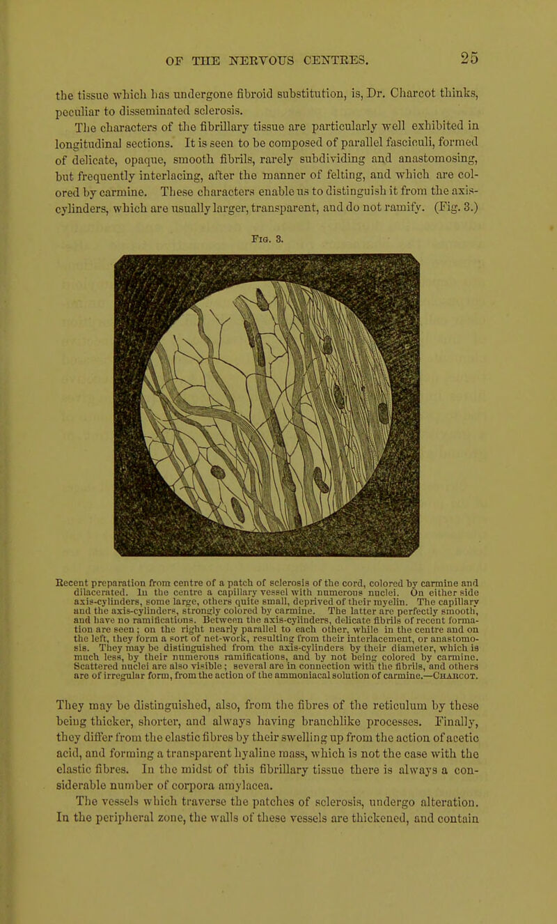 the tissue wliich lias undergone fibroid substitution, is, Dr. Charcot thinks, peculiar to disseminated sclerosis. The characters of the fibrillary tissue are particularly well exhibited in longitudinal sections. It is seen to be composed of parallel fasciculi, formed of delicate, opaque, smooth fibrils, rarely subdividing and anastomosing, but frequently interlacing, after the manner of felting, and which are col- ored by carmine. These characters enable us to distinguish it from the axis- cylinders, which are usually larger, transparent, and do not ramify. (Fig. 3.) FiQ. 3. Recent preparation from centre of a patch of sclerosis of the cord, colored by carmine and dilacenited. lu the centre a capillary vessel with nnmerons nnclei. On either side axis-cylinders, gome large, others quite small, deprived of their myelin. Tlie capillary and the axis-cylinders, stroniily colored hy carmine. The latter are perfectly smooth, and have no ramifications. Between the axis-cylinders, delicate fibrils of recent forma- tion are seen; on the right nearly parallel to each other, while in the centre and on the left, ihey form a sort of net-work, resultina; from their interlacement, or anastomo- sis. They may be distinguished from the axis-cylinders by their diameter, which is much less, by their nxtnierons ramifications, and by not being colored by carmine. Scattered nnclei are also visible; several are in connection with the fibrils, and others arc of irregular form, from the action of the ammoniacal solution of carmine.—Chahcot. They may bo distinguished, also, from tiie fibres of the reticulum by these being thicker, shorter, and always liaving branchliko processes. Finally, they difl^er from the elastic fibres by their swelling up from the action of acetic acid, and forming a transparent hyaline mass, which is not the case with the clastic fibres. In the midst of this fibrillary tissue there is always a con- siderable number of corpora araylacea. The vessels which traverse the patches of sclerosi.s, undergo alteration. In the peripheral zone, the walls of these vessels are thickened, and contain