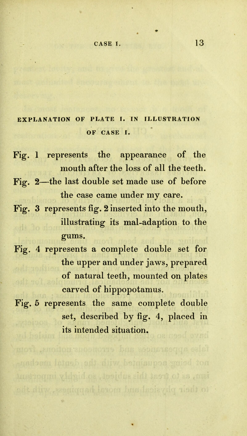 EXPLANATION OF PLATE I. IN ILLUSTRATION OF CASE I. Fig. 1 represents the appearance of the mouth after the loss of all the teeth. Fig. 2—the last double set made use of before the case came under my care. Fig. 3 represents fig. 2 inserted into the mouth, illustrating its mal-adaption to the gums. Fig. 4 represents a complete double set for the upper and under jaws, prepared of natural teeth, mounted on plates carved of hippopotamus. Fig. 5 represents the same complete double set, described by fig. 4, placed in its intended situation.