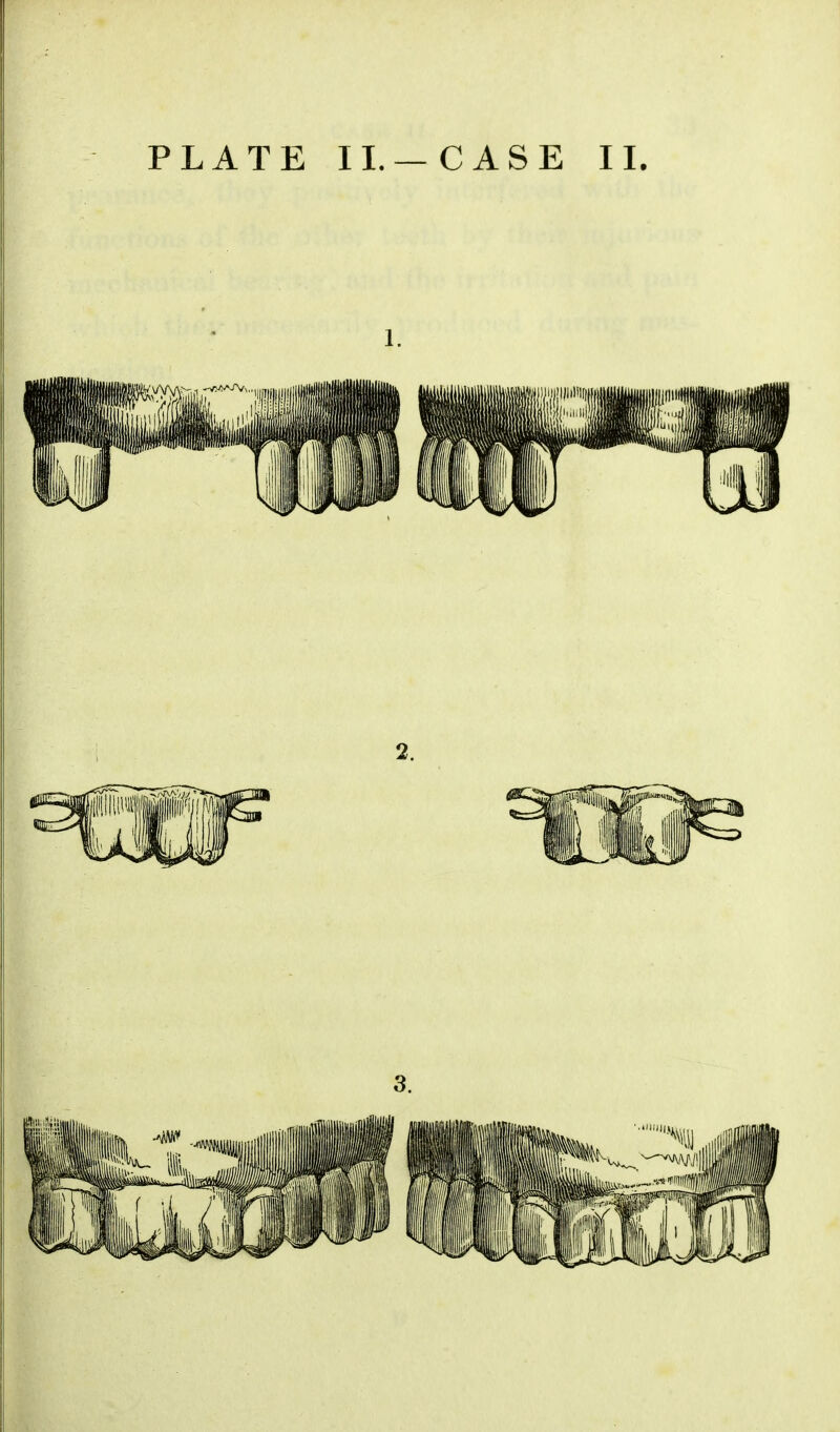 PLATE II.—CASE II. 1.