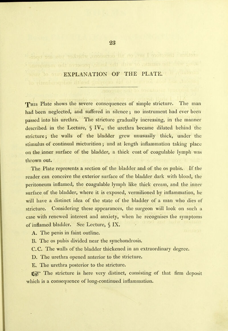 ^3 EXPLANATION OF THE PLATE. n^His Plate shows the severe consequences of snnple stricture. The man had been neglected, and suffered in silence ; no instrument had ever been passed into his urethra. The stricture gradually increasing, in the manner described in the Lecture, § IV., the urethra became dilated behind the stricture j the walls of the bladder grew unusually thick, under the stimulus of continual micturition ; and at length inflammation taking place on the inner surface of the bladder, a thick coat of coagulable lymph was thrown out. The Plate represents a section of the bladder and of the os pubis. If the reader can conceive the exterior surface of the bladder dark with blood, the peritoneum inflamed, the coagulable lymph like thick cream, and the inner surface of the bladder, where it is exposed, vermilioned by inflammation, he will have a distinct idea of the state of the bladder of a man who dies of stricture. Considering these appearances, the surgeon will look on such a case with renewed interest and anxiety, when he recognises the symptoms of inflamed bladder. See Lecture, § IX. A. The penis in faint outline. B. The OS pubis divided near the synchondrosis. C. C. The walls of the bladder thickened in an extraordinary degree. D. The urethra opened anterior to the stricture. E. The urethra posterior to the stricture. The stricture is here very distinct, consisting of that firm deposit which is a consequence of long-continued inflammation.