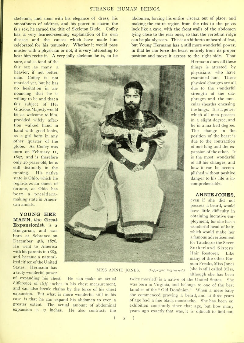 skeletons, and soon with his elegance of dress, his smoothness of address, and his power to charm the fair sex, he earned the title of Skeleton Dude. Coffey has a very learned-seeming explanation of his own disease and the causes which have made him celebrated for his tenuosity. Whether it would pass muster with a physician or not, it is very interesting to hear him recite it. A very jolly skeleton he is, to be sure, and as fond of the fair sex as many a heavier, if not better, man. Coffey is not married yet, but he has no hesitation in an- nouncing that he is willing to be and that a fair subject of Her Gracious Majesty would be as welcome to him, provided wifely affec- tion walked hand in hand with good looks, as a girl born in any other quarter of the globe. As Coffey was born on February 11, 1852, and is therefore only 46 years old, he is still distinctly in the running. His native state is Ohio, which he regards as an omen of fortune, as Ohio has been a president- making state in Ameri- can annals. YOUNG HER- MANN, the Great Expansionist, is a Hungarian, and was born at Sebrancz on December 4th, 1876. He went to America with his parents in 1883, and became a natural- izedcitizenof the United States. Hermann has a truly wonderful power of expanding his chest. He can make an actual difference of 16^ inches in his chest measurement, and can also break chains by the force of his chest expansion. But what is more wonderful still in his case is that he can expand his abdomen to even a greater extent. The actual amount of abdominal expansion is 17 inches. He also contracts the abdomen, forcing his entire viscera out of place, and making the entire region from the ribs to the pelvis look like a cave, with the front walls of the abdomen lying close to the rear ones, so that the vertebral ridge can be plainly seen. This is an hitherto unheard of feat, but Young Hermann has a still more wonderful power, in that he can force the heart entirely from its proper position and move it across to the right side. That Hermann does all these things is attested by physicians who have examined him. These physical changes are all due to the \/onderful strength of the dia- phragm and the mus- cular sheaths encasing the lungs. It is a power which all men possess m a slight degree, and he in a marked degree. The change in the position of the heart is due to the contraction of one lung and the ex- pansion of the other. It is the most wonderful of all his changes, and how it can be accom- plished without positive danger to his life is in- comprehensible. ANNIE JONES, even if she did not possess a beard, would have little difficulty in obtaining lucrative em- ployment, for she has a wonderful head of hair, which would make her a famous advertisement for Tatcho, or the Seven Sutherland Sisters' Hair Restorer. Like many of the other Bar- num Freaks, Miss Jones (she is still called Miss, although she has been twice married) is a native of the United States. She was born in Virginia, and belongs to one of the best families of the  Old Dominion. When a mere baby she commenced growing a beard, and at three years of age had a fine black moustache. She has been on exhibition constantly since that age, but how many years ago exactly that was, it is difficult to find out, MISS ANME JOXKS. (Copyright, Registered.}