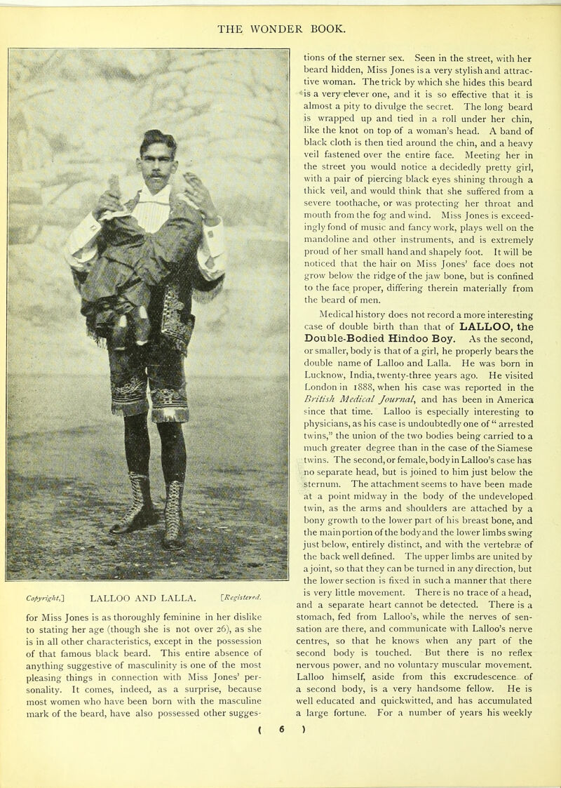 Copyright,-] LALLOO AND LALLA. [A'^s-«/W. for Miss Jones is as thoroughly feminine in her dislike to stating her age (though she is not over 26), as she is in all other characteristics, except in the possession of that famous black beard. This entire absence of anything suggestive of masculinity is one of the most pleasing things in connection with Miss Jones' per- sonality. It comes, indeed, as a surprise, because most women who have been born with the masculine mark of the beard, have also possessed other sugges- ( 6 tions of the sterner sex. Seen in the street, with her beard hidden. Miss Jones is a very stylish and attrac- tive woman. The trick by which she hides this beard is a very clever one, and it is so effective that it is almost a pity to divulge the secret. The long beard is wrapped up and tied in a roll under her chin, like the knot on top of a woman's head. A band of black cloth is then tied around the chin, and a heavy veil fastened over the entire face. Meeting her in the street you would notice a decidedly pretty girl, with a pair of piercing black eyes shining through a thick veil, and would think that she suffered from a severe toothache, or was protecting her throat and mouth from the fog and wind. Miss Jones is exceed- ingly fond of music and fancy work, plays well on the mandoline and other instruments, and is extremely proud of her small hand and shapely foot. It will be noticed that the hair on Miss Jones' face does not grow below the ridge of the jaw bone, but is confined to the face proper, differing therein materially from the beard of men. Medical history does not record a more interesting case of double birth than that of LALLOO, the Double-Bodied Hindoo Boy. As the second, or smaller, body is that of a girl, he properly bears the double name of Lalloo and Lalla. He was born in Lucknow, India, twenty-three years ago. He visited London in 1888, when his case was reported in the British Medical Journal, and has been in America since that time. Lalloo is especially interesting to physicians, as his case is undoubtedly one of  arrested twins, the union of the two bodies being carried to a much greater degree than in the case of the Siamese twins. The second, or female, body in Lalloo's case has '• no separate head, but is joined to him just below the sternum. The attachment seems to have been made at a point midway in the body of the undeveloped twin, as the arms and shoulders are attached by a bony growth to the lower part of his breast bone, and the main portion of the body and the lower limbs swing just below, entirely distinct, and with the vertebra of the back well defined. The upper limbs are united by a joint, so that they can be turned in any direction, but the lower section is fixed in such a manner that there is very little movement. There is no trace of a head, and a separate heart cannot be detected. There is a stomach, fed from Lalloo's, while the nerves of sen- sation are there, and communicate with Lalloo's nerve centres, so that he knows when any part of the second body is touched. But there is no reflex nervous power, and no voluntary muscular movement. Lalloo himself, aside from this excrudescence of a second body, is a very handsome fellow. He is well educated and quickwitted, and has accumulated a large fortune. For a number of years his weekly )