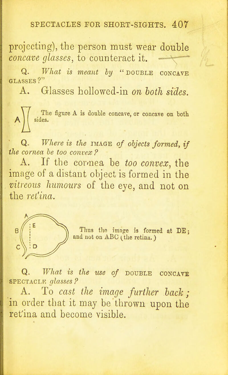 projecting), the person must wear double concave glasses, to counteract it. —-\— Q. What is meant by  double concave GLASSES? A. Glasses hollowed-in on both sides. The figure A is doable concave, or concave on both sides. Q. Where is the image of objects formed, if the cornea be too convex ? A. If the cordiea be too convex, the image of a distant object is formed in the vitreous humours of the eye, and not on the ret'ina. at DE; Q. JVhat is the use of double concave SPECTACLK glasses ? A. To cast the image further hack ; in order that it may be thrown upon the ret'ina and become visible.
