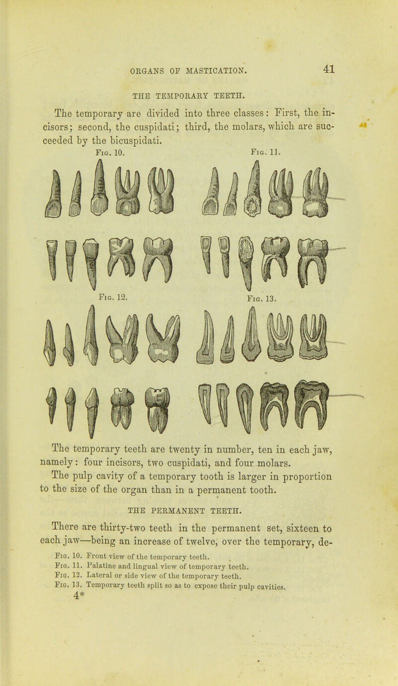 THE TEMPORARY TEETH. The temporary are divided into three classes : First, the in- cisors ; second, the cuspidati; third, the molars, which are suc- ceeded by the bicuspidati. Fig. 10. Fig. 11. The temporary teeth are twenty in number, ten in each jaw, namely: four incisors, two cuspidati, and four molars. The pulp cavity of a temporary tooth is larger in proportion to the size of the organ than in a permanent tooth. THE PERMANENT TEETH. There are thirty-two teeth in the permanent set, sixteen to each jaw—being an increase of twelve, over the temporary, de- Fio. 10. Front view of the temporary teeth. Fio. 11. Palatine and lingual view of temporary teeth. Fig. 12. Lateral or side view of the temporary teeth. Fig. 13. Temporary teeth split so as to expose their pulp cavities.