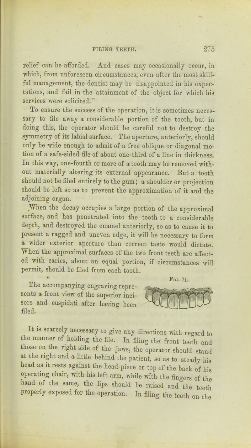 relief can be afforded. And cases may occasionally occur, in •which, from unforeseen circumstances, even after the most skill- ful management, the dentist may be disappointed in his expec- tations, and fail in the attainment of the object for •which his services were solicited.” To ensure the success of the operation, it is sometimes neces- sary to file away a considerable portion of the tooth, but in doing this, the operator should be careful not to destroy the symmetry of its labial surface. The aperture, anteriorly, should only be wide enough to admit of a free oblique or diagonal mo- tion of a safe-sided file of about one-third of a line in thickness. In this way, one-fourth or more of a tooth may be removed with- out materially altering its external appearance. But a tooth should not be filed entirely to the gum; a shoulder or projection should be left so as to prevent the approximation of it and the adjoining organ. When the decay occupies a large portion of the approximal surface, and has penetrated into the tooth to a considerable depth, and destroyed the enamel anteriorly, so as to cause it to present a ragged and uneven edge, it will be necessary to form a wider exterior aperture than correct taste would dictate. When the approximal surfaces of the two front teeth are affect- ed with caries, about an equal portion, if circumstances will permit, should be filed from each tooth. * . Fig. 71. The accompanying engraving repre- sents a front view of the superior inci- sors and cuspidati after havin'^ been filed. It is scarcely necessary to give any directions with regard to the manner of holding the file. In filing the front teeth and those on the right side of the jaws, the operator should stand at the right and a little behind the patient, so as to steady his head as it rests against the head-piece or top of the back of his operating chair, with his left arm, while with the fingers of the hand of the same, the lips should be raised and the teeth properly exposed for the operation. In filing the teeth on the