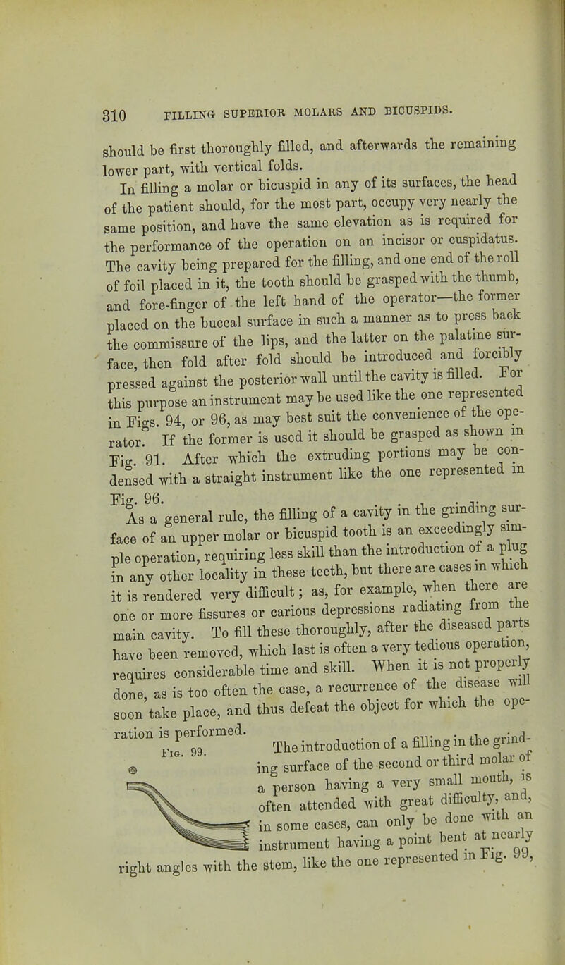 should be first thoroughly filled, and afterwards the remaining lower part, with vertical folds. In filling a molar or bicuspid in any of its surfaces, the head of the patient should, for the most part, occupy very nearly the same position, and have the same elevation as is required for the performance of the operation on an incisor or cuspidatus. The cavity being prepared for the filling, and one end of the roll of foil placed in it, the tooth should be grasped with the thumb, and fore-finger of the left hand of the operator-the former placed on the buccal surface in such a manner as to press back the commissure of the lips, and the latter on the palatine sur- face, then fold after fold should be introduced^ and forcibly pressed against the posterior wall until the cavity is filled. For this purpose an instrument may be used like the one represented in Figs 94, or 96, as may best suit the convenience of the ope- rator. If the former is used it should be grasped as shown in Fig 91 After which the extruding portions may be con- densed with a straight instrument like the one represented in Fig. 96. , . As a general rule, the filling of a cavity in the grinding sur- face of an upper molar or bicuspid tooth is an exceedingly sim- ple operation, requiring less skill than the introduction of a plug in any other locality in these teeth, but there are cases in which it is rendered very difficult; as, for example, when there are one or more fissures or carious depressions radiating from the main cavity. To fill these thoroughly, after the diseased parts have been removed, which last is often a very tedious operation, requires considerable time and skill. When it is not propei y doL as is too often the case, a recurrence of the disease wi soon’take place, and thus defeat the object for which the ope- ration is perfo introduction of a filling in the grind- ing surface of the second or third molar o a person having a very small mouth, is often attended with great difficulty, and, in some cases, can only be done wit an instrument having a point bent at nearly right angles with the stem, like the one represented in big. JJ,
