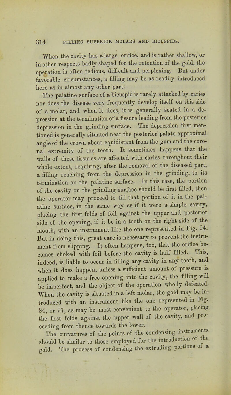 When the cavity has a large orifice, and is rather shallow, or in other respects badly shaped for the retention of the gold, the operation is often tedious, difiBcult and perplexing. But under favorable circumstances, a filling may be as readily introduced here as in almost any other part. The palatine surface of a bicuspid is rarely attacked by caries nor does the disease very frequently develop itself on this side of a molar, and when it does, it is generally seated in a de- pression at the termination of a fissure leading from the posterior depression in the grinding surface. The depression first men- tioned is generally situated near the posterior palato-approximal angle of the crown about equidistant from the gum and the coro- nal extremity of the tooth. It sometimes happens that the walls of these fissure’s are affected with caries throughout their whole extent, requiring, after the removal of the diseased part, a filling reaching from the depression in the grinding, to its termination on the palatine surface. In this case, the portion of the cavity on the grinding surface should be first filled, then the operator may proceed to fill that portion of it in the pal- atine surface, in the same way as if it were a simple cavity, placing the first folds of foil against the upper and posterior side of the opening, if it he in a tooth on the right side of the mouth, with an instrument like the one represented in Fig. 94. But in doing this, great care is necessary to prevent the instru- ment from slipping. It often happens, too, that the orifice be- comes choked with foil before the cavity is half filled. This, indeed, is liable to occur in filling any cavity in any tooth, and when it does happen, unless a sufficient amount of pressure is applied to make a free opening into the cavity, the filling will be imperfect, and the object of the operation wholly defeated. When the cavity is situated in a left molar, the gold may be in- troduced with an instrument like the one reprsented in Fig. 84, or 97, as may be most convenient to the operator, placing the first folds against the upper wall of the cavity, and pio ceeding from thence towards the lower. The curvatures of the points of the condensing instrumen s should be similar to those employed for the introduction ^ ^ ® gold. The process of condensing the extruding portions o a