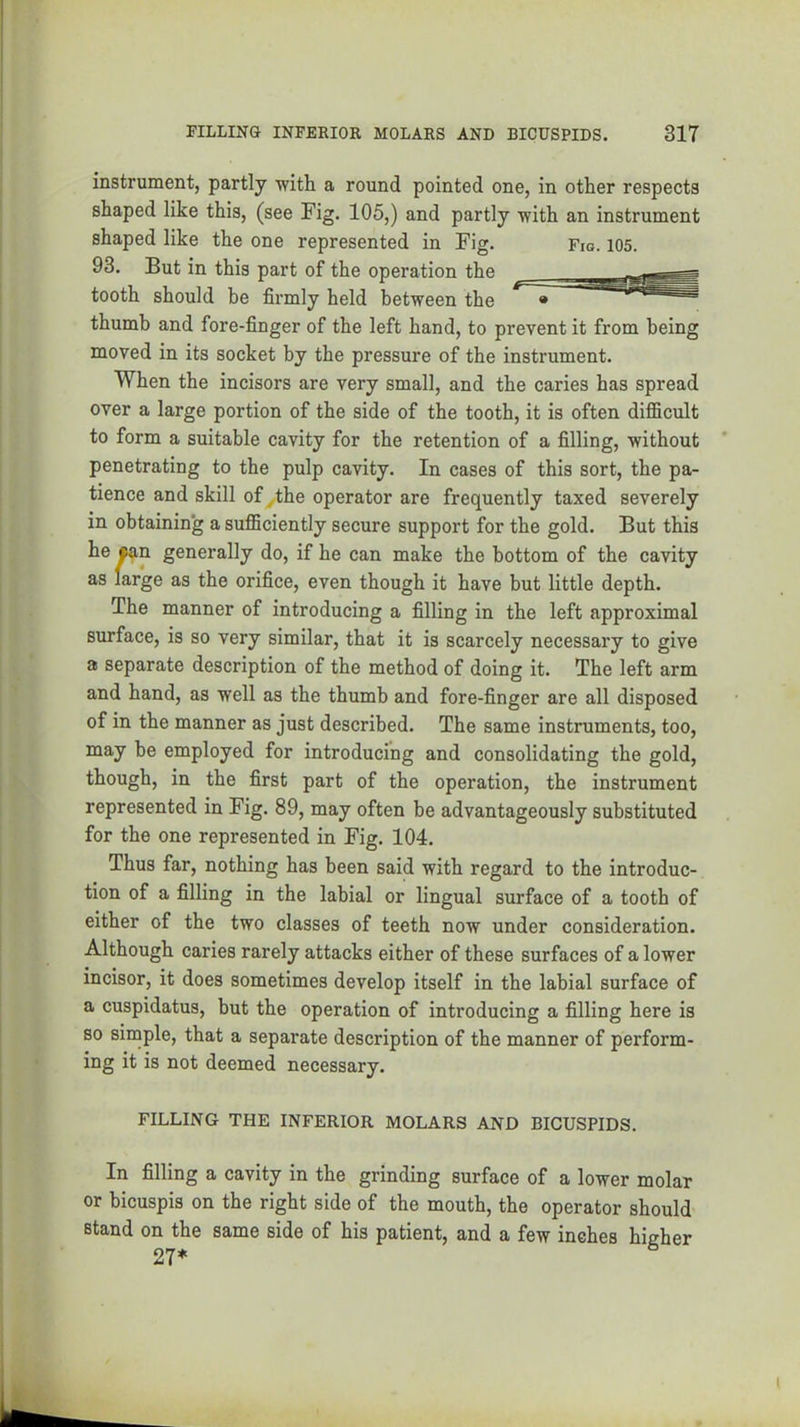 instrument, partly ■with a round pointed one, in other respects shaped like this, (see Fig. 105,) and partly with an instrument shaped like the one represented in Fig. Fig. 105. 93. But in this part of the operation the tooth should be firmly held between the thumb and fore-finger of the left hand, to prevent it from being moved in its socket by the pressure of the instrument. When the incisors are very small, and the caries has spread over a large portion of the side of the tooth, it is often difficult to form a suitable cavity for the retention of a filling, without penetrating to the pulp cavity. In cases of this sort, the pa- tience and skill ofythe operator are frequently taxed severely in obtaining a sufficiently secure support for the gold. But this he wn generally do, if he can make the bottom of the cavity as large as the orifice, even though it have but little depth. The manner of introducing a filling in the left approximal surface, is so very similar, that it is scarcely necessary to give a separate description of the method of doing it. The left arm and hand, as well as the thumb and fore-finger are all disposed of in the manner as just described. The same instruments, too, may be employed for introducing and consolidating the gold, though, in the first part of the operation, the instrument represented in Fig. 89, may often be advantageously substituted for the one represented in Fig. 104. Thus far, nothing has been said with regard to the introduc- tion of a filling in the labial or lingual surface of a tooth of either of the two classes of teeth now under consideration. Although caries rarely attacks either of these surfaces of a lower incisor, it does sometimes develop itself in the labial surface of a cuspidatus, but the operation of introducing a filling here is so simple, that a separate description of the manner of perform- ing it is not deemed necessary. FILLING THE INFERIOR MOLARS AND BICUSPIDS. In filling a cavity in the grinding surface of a lower molar or bicuspis on the right side of the mouth, the operator should stand on the same side of his patient, and a few inches higher 27*
