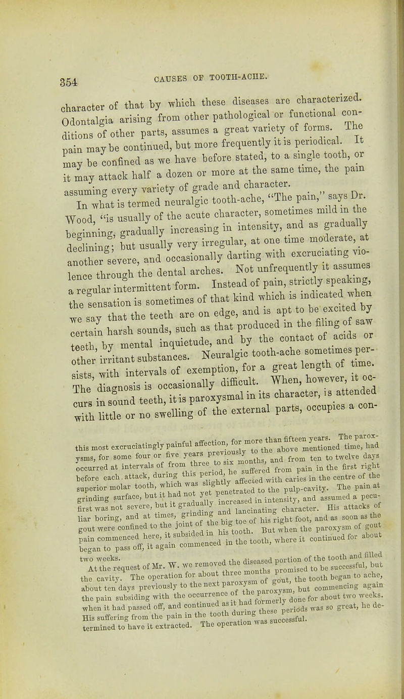 character of that by rrhioh these diseases are oharaetenzed. Odontalgia arising from other pathological or funet.onal con- ditions of other parts, assumes a great ra^nety of forms. The pain maybe continued, but more frequently rtis penodical It Ly be confined as rre have before Staten, to a single ooth, or it Ly attack half a dozen or more at the same time, the pain assuming every variety of grade and character. In tvhat is termed neuralgic tooth-ache, “The pain, says Dr Wood, “is usually of the acute character, sometimes mild in the beginning, gradually increasing in intensity, and as gia ua y de!unin4 L usually very irregular, at one time moderate, at another°severe, and occasionally darting with excruciating v. - lence through the dental arches. Not unfrequently it assumes a regular inlrmittent form. Instead of pain, strictly speaking the Sensation is sometimes of that kind which is indicated when we ;; that the teeth are on edge, and is apt certain harsh sounds, such as that produced in the filing of saw tfipth by mental inquietude, and by the contact of acids o*er’ irritant substances. Neuralgic tooth-ache sometimes pm- aists with intervals of exemption, for a great leng The dlgnosis is occasionally difflcult. When, however it oc^ The itisnaroxysmalinitscharacter.is attended “ror no spelling of the external parts, occupies a con- this most ezoruciatingly painful affection, ^‘^“a^^^'^mentioned time, bad for some tour or 6v. years ten to twelve days ooourred at interval, of from three ,he first rigUt before each attack, during is f ’ geg with eariea in the centre of the snp.riorm.lar «>■; f t^pl^euSrto the puip-oavit,. Tb. pain at grinding surface,‘ JJ,, increased in intensity, and assumed a peen- first was not severe, but xt graciua y lancinating character. His attacks of liar boring, and at times, giin g the gout were confined to the fiis^tooth. But when the paroxysm of gout 'Tt ftfrignest otMr. W. wo pr2s°fm bVs°.1L“ub^^^^ the cavity. The operation for about ^ tooth began to ache, about ten days previously to the nex J but commencing again the pain subsiding with the occurren formerly done for about two weeks, when it had passed off, and continue ^ periods was so great, ho de- His suffering from the pain in the tooth termined to have it extracted. The operation was success