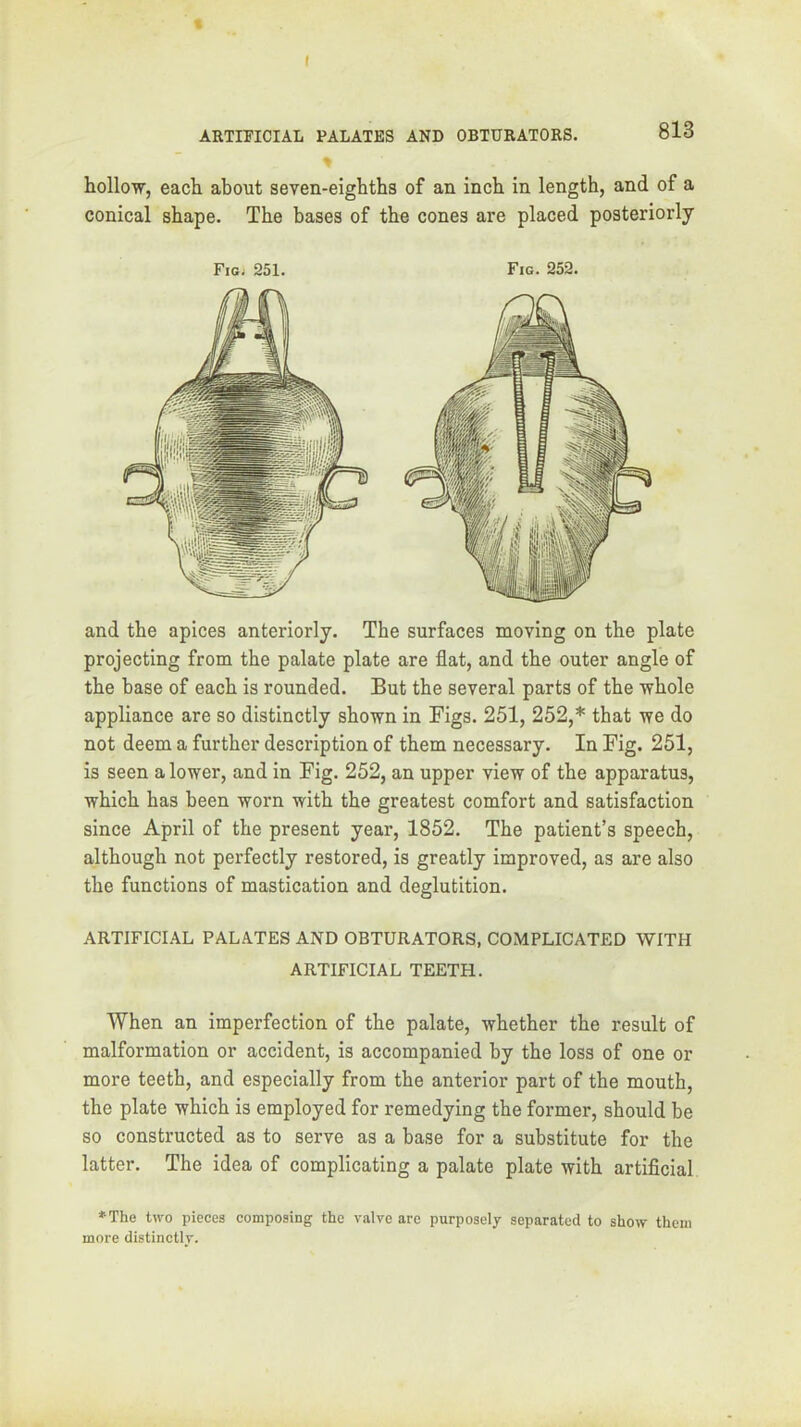 f ARTIFICIAL PALATES AND OBTURATORS. 813 hollow, each about seven-eighths of an inch in length, and of a conical shape. The bases of the cones are placed posteriorly Fig- 251. Fig. 252. and the apices anteriorly. The surfaces moving on the plate projecting from the palate plate are flat, and the outer angle of the base of each is rounded. But the several parts of the whole appliance are so distinctly shown in Figs. 251, 252,* that we do not deem a further description of them necessary. In Fig. 251, is seen a lower, and in Fig. 252, an upper view of the apparatus, which has been worn with the greatest comfort and satisfaction since April of the present year, 1852. The patient’s speech, although not perfectly restored, is greatly improved, as are also the functions of mastication and deglutition. ARTIFICIAL PALATES AND OBTURATORS, COMPLICATED WITH ARTIFICIAL TEETH. When an imperfection of the palate, whether the result of malformation or accident, is accompanied by the loss of one or more teeth, and especially from the anterior part of the mouth, the plate which is employed for remedying the former, should be so constructed as to serve as a base for a substitute for the latter. The idea of complicating a palate plate with artiflcial *The tivo pieces composing the valve are purposely separated to show them more distinctly.