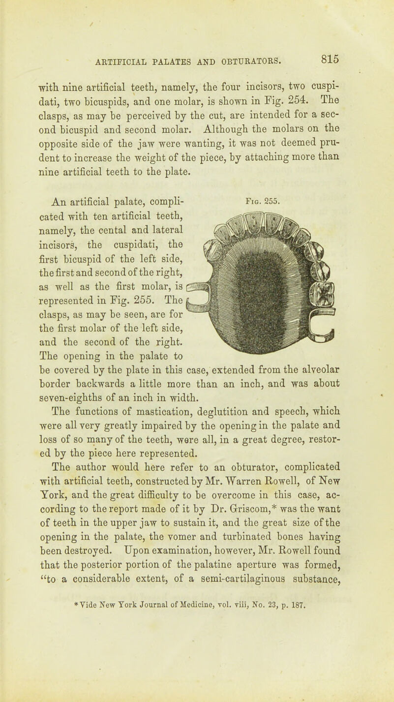 witli nine artificial teeth, namely, the four incisors, two cuspi- dati, two bicuspids, and one molar, is shown in Fig. 254. The clasps, as may be perceived by the cut, are intended for a sec- ond bicuspid and second molar. Although the molars on the opposite side of the jaw were wanting, it was not deemed pru- dent to increase the weight of the piece, by attaching more than nine artificial teeth to the plate. An artificial palate, compli- Fig. 255. cated with ten artificial teeth, namely, the cental and lateral incisors, the cuspidati, the first bicuspid of the left side, the first and second of the right, as well as the first molar, is represented in Fig. 255. The clasps, as may be seen, are for the first molar of the left side, and the second of the right. The opening in the palate to be covered by the plate in this case, extended from the alveolar border backwards a little more than an inch, and was about seven-eighths of an inch in width. The functions of mastication, deglutition and speech, which were all very greatly impaired by the opening in the palate and loss of so many of the teeth, were all, in a great degree, restor- ed by the piece here represented. The author would here refer to an obturator, complicated with artificial teeth, constructed by Mr. Warren Rowell, of New York, and the great difficulty to be overcome in this case, ac- cording to the report made of it by Dr. Griscom,* was the want of teeth in the upper jaw to sustain it, and the great size of the opening in the palate, the vomer and turbinated bones having been destroyed. Upon examination, however, Mr. Rowell found that the posterior portion of the palatine aperture was formed, “to a considerable extent, of a semi-cartilaginous substance, *Vide New York Journal of Medicine, vol. viii, No. 23, p. 187.