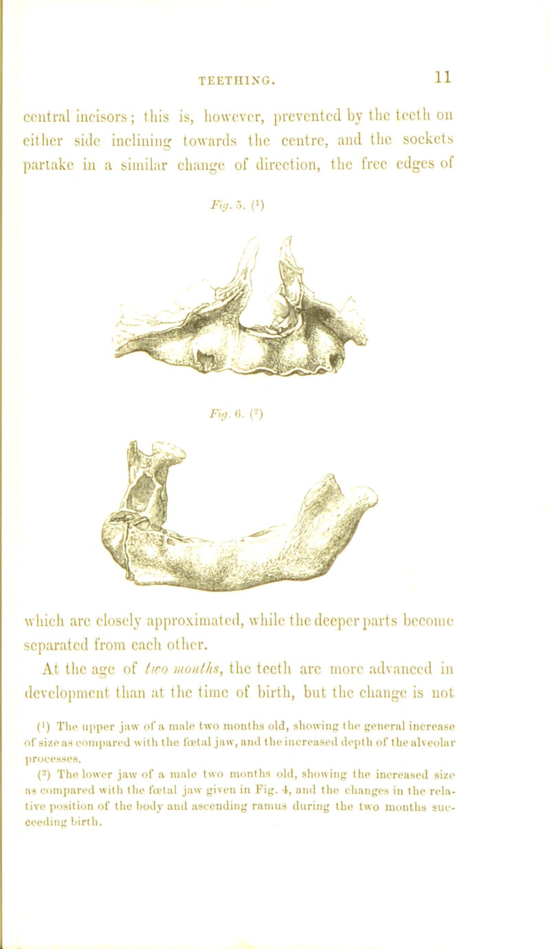 central incisors; this is, however, prevented by the teeth ou either side inclining towards the centre, and the sockets partake in a similar change of direction, the free edges ol which arc closely approximated, while the deeper parts become separated from each other. At the age of two months, the teeth are more advanced in development than at the time of birth, but the change is not (') The upper jaw of a mule two months old, showing the general increase of size as compared «ilh the foetal jaw, and the increased depth of the alveolar processes. (2) The lower jaw of a male two months old, showing the increased size as compared with the foetal jaw given in Fig. 4, and the changes in the rela- tive position of the body aud ascending ramus during the two months suc- ceeding birth. Fig. ■>. (i) Fig.e. (»)