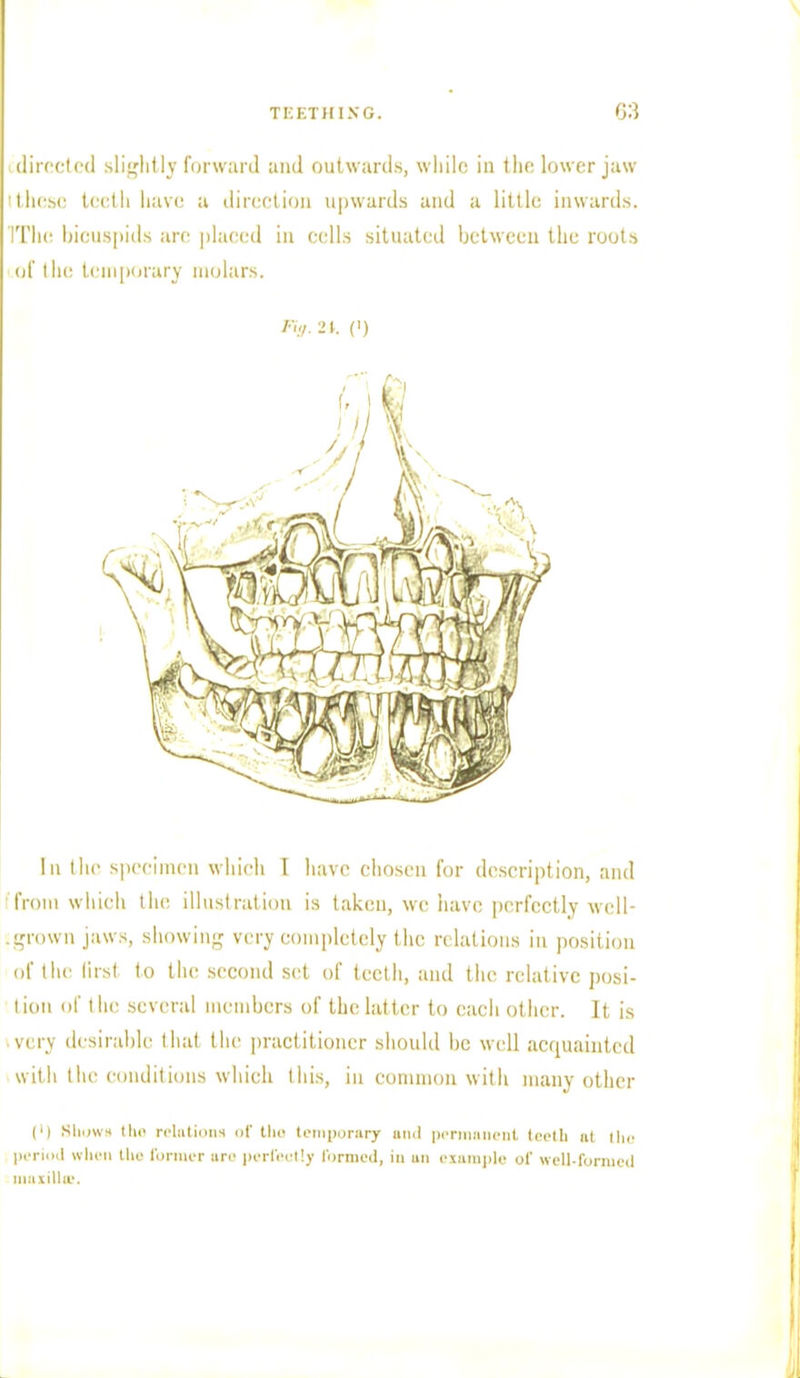 directed slightly forward and outwards, while in the lower jaw I these teeth have a direction upwards and a little inwards. IThc bicuspids are placed in cells situated between the roots of the temporary molars. Bg.U. (i) In the specimen which I have chosen for description, and from which the, illustration is taken, we have perfectly well- grown jaws, showing very completely the relations iii position of the first to the second set of teeth, and the relative posi- tion of the several members of the latter to each other. It is • very desirable that the practitioner should be well acquainted with the conditions which this, in common with many other C) Shows tho relations of the temporary and permanent teeth at the period when the former arc perfect!; formed, in an example of well-formed maxillae.