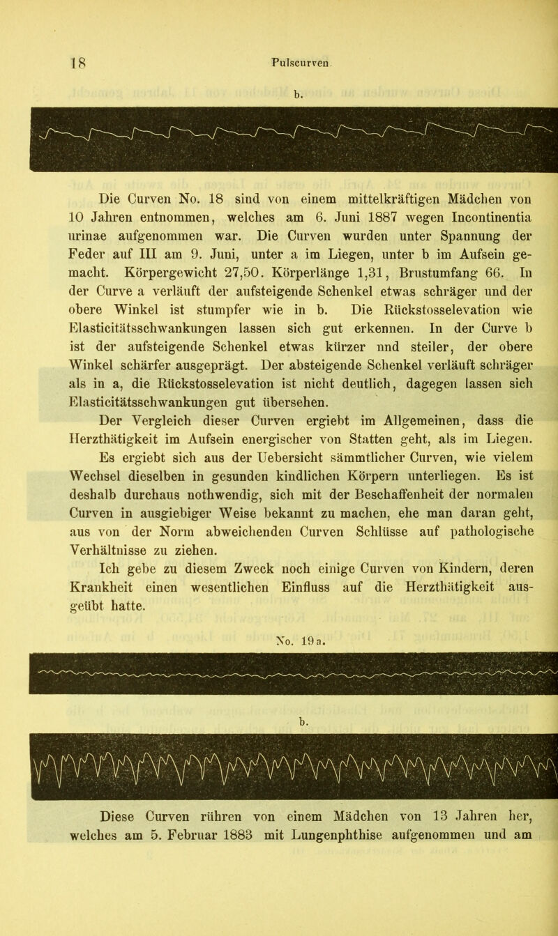 b. Die Curven No. 18 sind von einem mittelkräftigen Mädchen von 10 Jahren entnommen, welches am 6. Juni 1887 wegen Incontinentia urinae aufgenommen war. Die Curven wurden unter Spannung der Feder auf III am 9. Juni, unter a im Liegen, unter b im Aufsein ge- macht. Körpergewicht 27,50. Körperlänge 1,31, Brustumfang 66. In der Curve a verläuft der aufsteigende Schenkel etwas schräger und der obere Winkel ist stumpfer wie in b. Die Rückstosselevation wie Elasticitätsschwankungen lassen sich gut erkennen. In der Curve b ist der aufsteigende Schenkel etwas kürzer und steiler, der obere Winkel schärfer ausgeprägt. Der absteigende Schenkel verläuft schräger als in a, die Rückstosselevation ist nicht deutlich, dagegen lassen sich Elasticitätsschwankungen gut übersehen. Der Vergleich dieser Curven ergiebt im Allgemeinen, dass die Herzthätigkeit im Aufsein energischer von Statten geht, als im Liegen. Es ergiebt sich aus der Uebersicht sämmtlicher Curven, wie vielem Wechsel dieselben in gesunden kindlichen Körpern unterliegen. Es ist deshalb durchaus nothwendig, sich mit der Beschaffenheit der normalen Curven in ausgiebiger Weise bekannt zu machen, ehe man daran geht, aus von der Norm abweichenden Curven Schlüsse auf pathologische Verhältnisse zu ziehen. Ich gebe zu diesem Zweck noch einige Curven von Kindern, deren Krankheit einen wesentlichen Einfluss auf die Herzthätigkeit aus- geübt hatte. Xo. 19 a. Diese Curven rühren von einem Mädchen von 13 Jahren her, welches am 5. Februar 1883 mit Lungenphthise aufgenommen und am