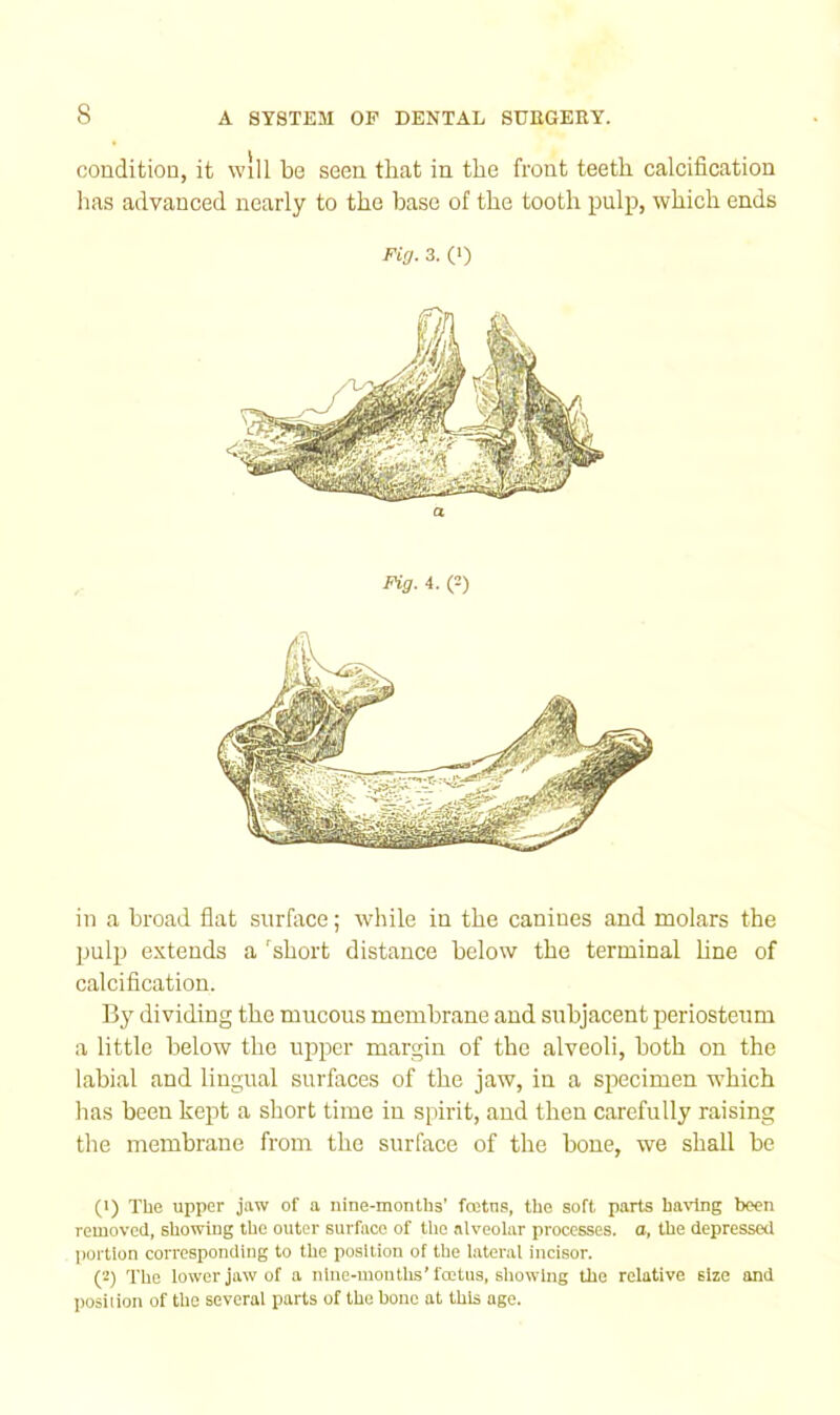 condition, it will be seen that in the front teeth calcification has advanced nearly to the base of the tooth pulp, which ends Fig. 3. (I) in a broad flat surface; while in the canines and molars the pulp extends a 'short distance below the terminal hne of calcification. By dividing the mucous membrane and subjacent periosteiim a little below the upper margin of the alveoli, both on the labial and lingual surfaces of the jaw, in a si^ecimen w’hich has been kept a short time in spirit, and then carefully raising the membrane from the surface of the bone, we shall be (>) The upper jaw of a nine-months’ fojtns, the soft parts having been removed, showing the outer surface of the alveolar processes, a, the depressed l)ortlon corresponding to the position of the lateral incisor. (2) The lower jaw of a nine-mouths’foetus, showing the relative size and Ijosiiion of the several parts of the bone at this age.