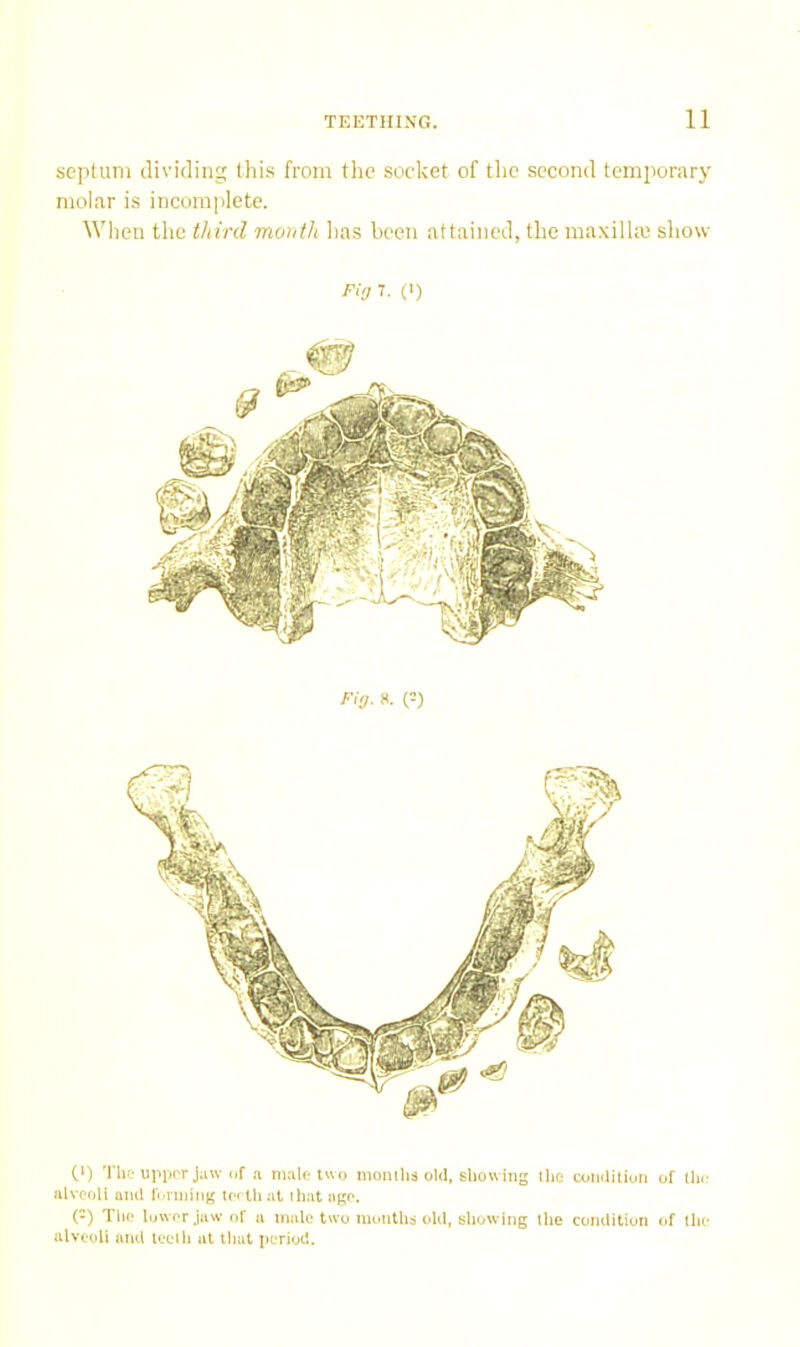 septum dividing this from the socket of tlio second temporary molar is incomplete. Wlien the third month has been attained, the raa.xillai show Flo 7. (>) Fig. s. (=) 0) The upiior jaw of a male two moiiilis old, showing llio coiiditiun of the ulvooli ami forming icrth at that ago. (-) Tlio luworjaw of a male two iiumths olil, showing the cumlition of the alveoli ami teeth at that period.