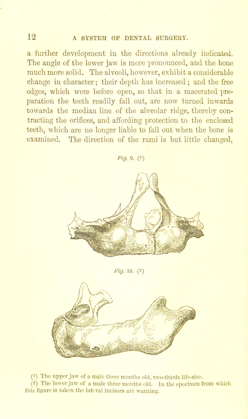 a further development in the directions already indicated. The angle of the lower jaw is more pronounced, and the bone much more solid. The alveoli, however, exhibit a considerable change in character; their depth has increased; and the free edges, which were before open, so that in a macerated pre- paration the teeth readily fall out, are now turned inwards towards the median line of the alveolar ridge, thereby con- tracting the orifices, and affording protection to the enclosed teeth, which are no longer liable to fall out when the bone is examined. The direction of the rami is but little changed, Pig. 9. (0 Fig. 10. (2) (1) The upper jaw of a male three mouths old, two-thirds life-size. (2) The lower jaw of a male tliree months old. In the specimen from which tins flpurc is taken the lateral incisors are wanting.