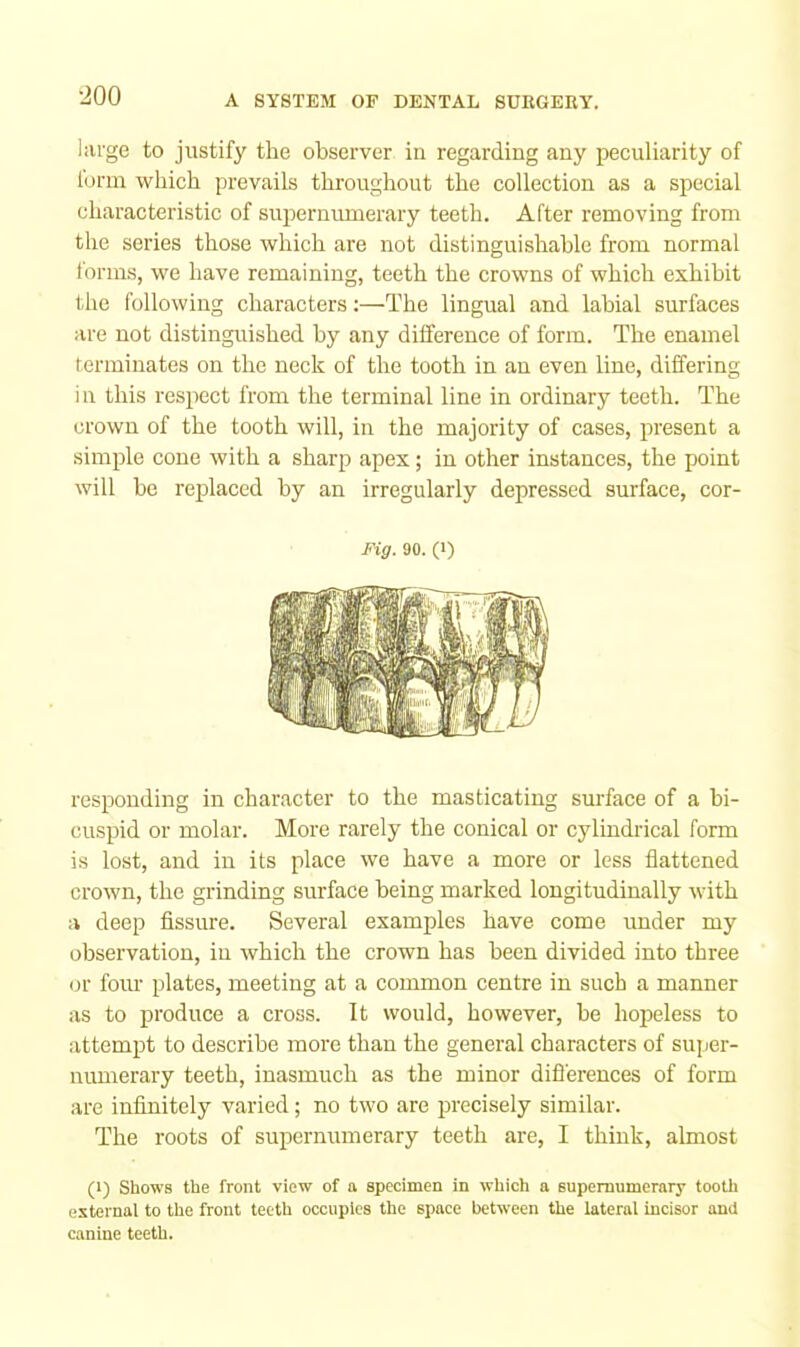 ■200 large to justify the observer in regarding any peculiarity of form which prevails throughout the collection as a special characteristic of supernumerary teeth. After removing from the series those which are not distinguishable from normal I'orms, we have remaining, teeth the crowns of which exhibit the following characters:—The lingual and labial surfaces are not distinguished by any difference of form. The enamel terminates on the neck of the tooth in an even line, differing in this respect from the terminal line in ordinary teeth. The crown of the tooth will, in the majority of cases, present a simp)le cone with a sharp apex; in other instances, the point will be replaced by an irregularly depressed surface, cor- Fig. 90. (1) responding in character to the masticating surface of a bi- cuspid or molar. More rarely the conical or cylindrical form is lost, and in its place we have a more or less flattened crown, the grinding surface being marked longitudinally with a deep fissure. Several examples have come under my observation, in which the crown has been divided into three or four plates, meeting at a common centre in such a manner as to produce a cross. It would, however, be hopeless to attempt to describe more than the general characters of super- numerary teeth, inasmuch as the minor difl'erences of form are infinitely varied; no two are precisely similar. The roots of supernumerary teeth are, I think, almost (1) Shows the front view of a specimen in which a supernumerary tooth esternai to the front teeth occupies the space between the lateral incisor and canine teeth.