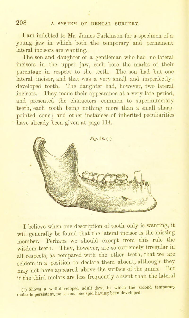 I am indebted to Mr. James Parkinson for a specimen of a young jaw in which both the temporary and permanent lateral incisors are wanting. The son and daughter of a gentleman who had no lateral incisors in the upper jaw, each bore the marks of their parentage in respect to the teeth. The son had but one lateral incisor, and that was a very small and imperfectly- developed tooth. The daughter had, however, two lateral incisors. They made their appearance at a very late j)eriod, and presented the characters common to supernumerary teeth, each tooth being nothing more than a small sharp- pointed cone; and other instances of inherited peculiarities have already been given at page 114. I believe when one description of tooth only is wanting, it will generally be found that the lateral incisor is the missing member. Perhaps we should except from this rule the wisdom teeth. They, however, are so extremely irregular in all respects, as compared with the other teeth, that we are seldom in a position to declare them absent, although they may not have appeared above the surface of the gums. But if the third molars are less frequently absent than the lateral (1) Shows a well-developed adult jaw, in which the second temporary molar Is persistent, no second bicuspid having been developed.