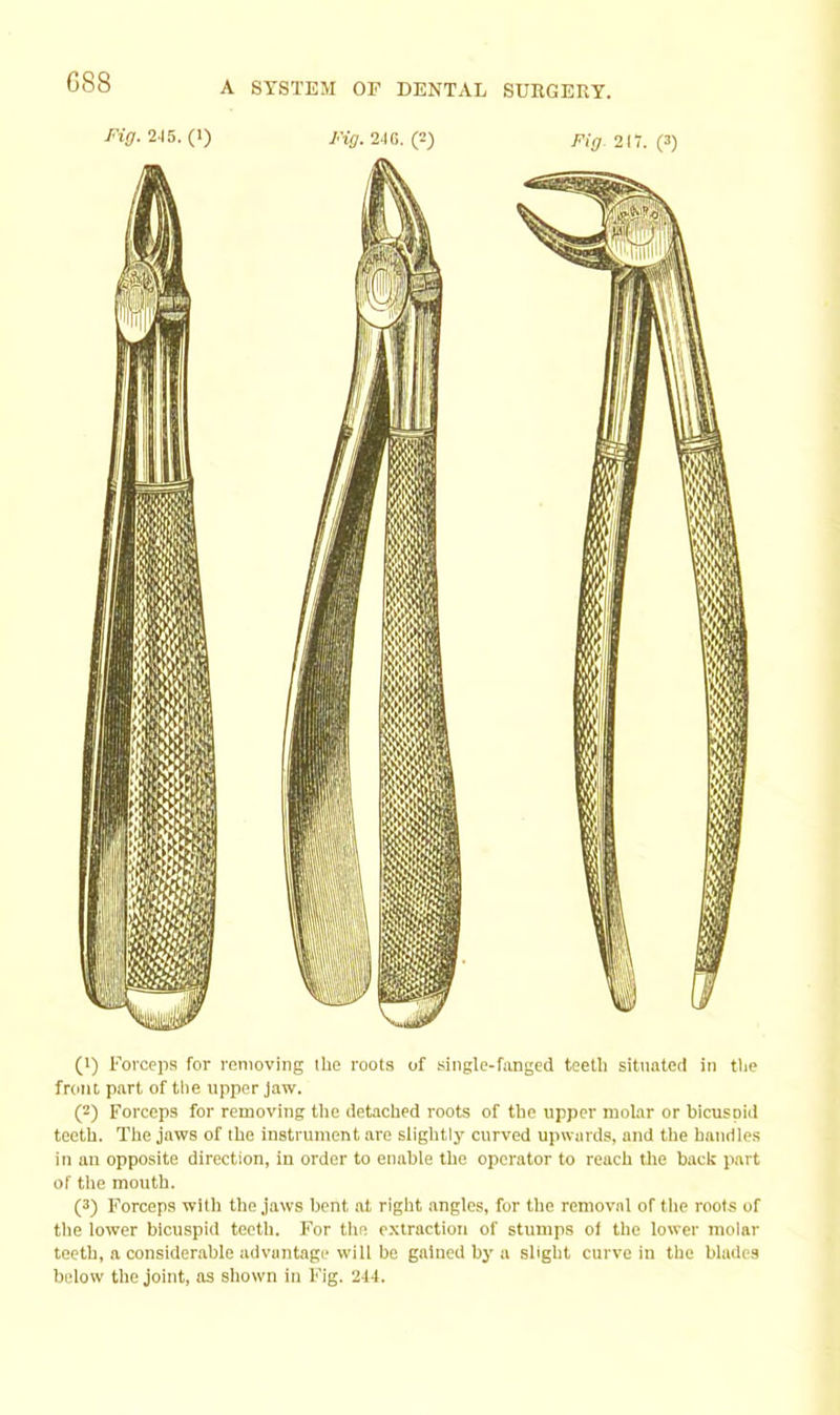 GS8 Fig. 245. (1) Fig. 24 G. (2) Fig- 217. (3) (1) Forceps for removing ihe roots of singlc-fanged teeth situated in tlje front part of the upper Jaw. (2) Forceps for removing the detached roots of the upper molar or bicuspid teeth. The jaws of the instrument are slightly curved upwards, and the handles in an opposite direction, in order to enable the operator to reach the back part of the mouth. (3) Forceps with the jaws bent at right .angles, for the removal of the roots of the lower bicuspid teeth. For the extraction of stumps of the lower molar teeth, a considerable advantage will be gained by a slight curve in the blades below the joint, as shown in Fig. 214.