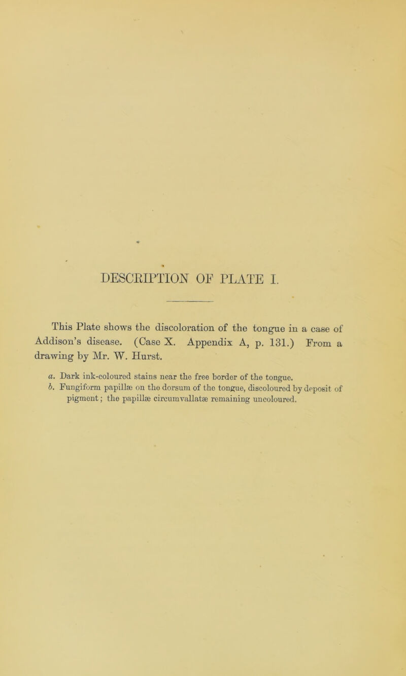 This Plate shows the discoloration of the tongue in a case of Addison’s disease. (Case X. Appendix A, p. 131.) From a drawing by Mr. W. Hurst. a. Dark ink-coloured stains near the free border of the tongue. b. Fungiform papillse on tho dorsum of tho tongue, discoloured by deposit of pigment; the papillse circumvallatse remaining uncoloured.